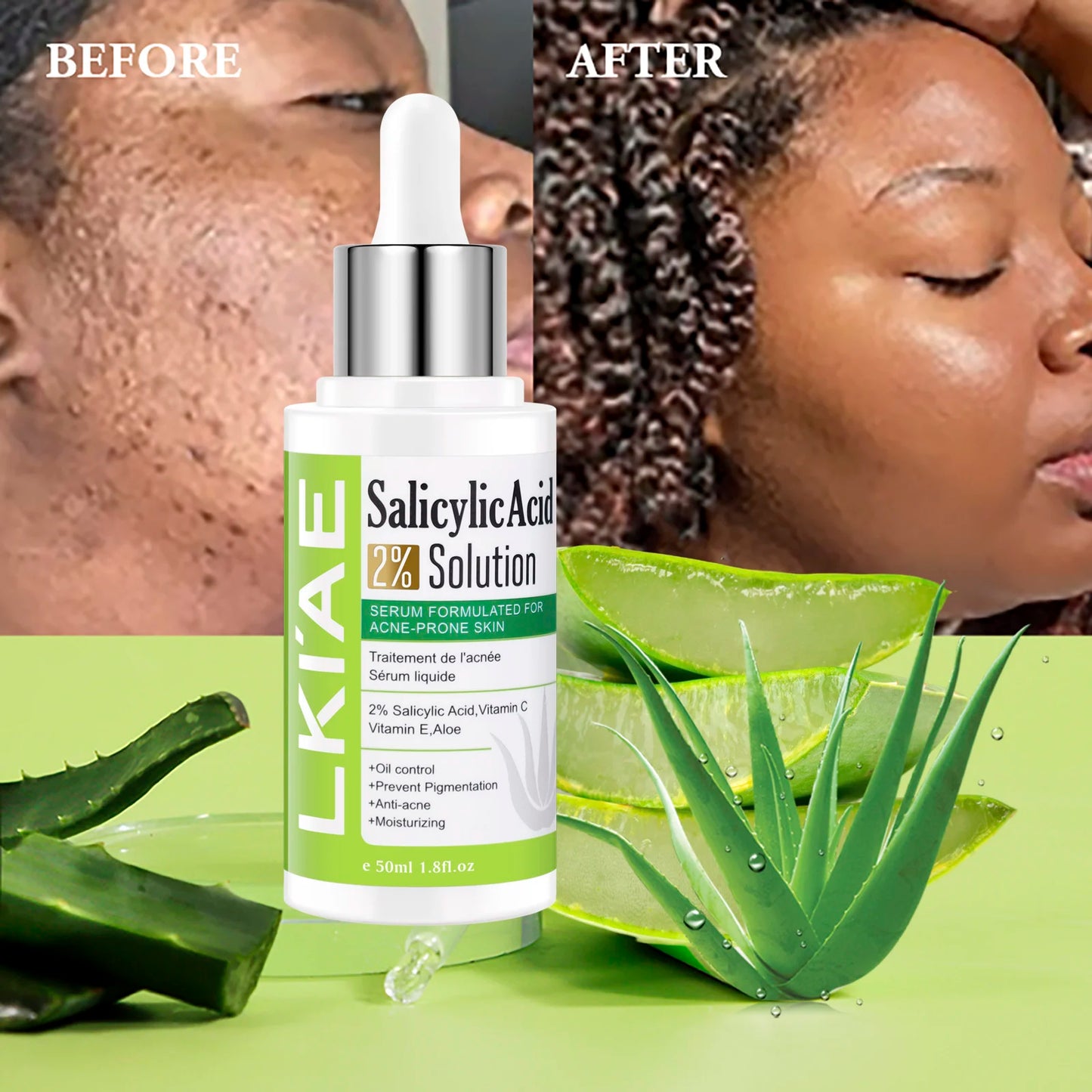 AILKE Aloe Vera Brightening Face Serum – Vitamin C & E, 50ml