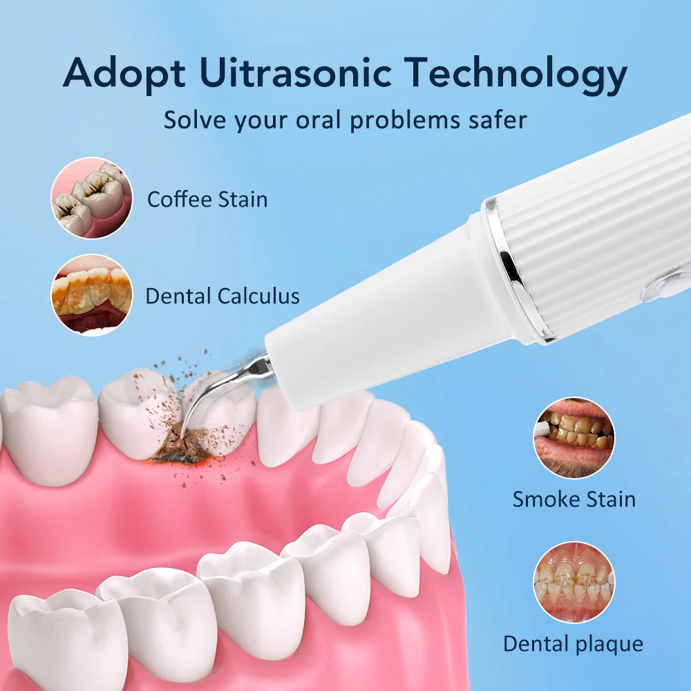 Electric Teeth Cleaner Dental Scaler Plaque Tartar Calculus Stain Remover Oral Care Rechargeable Home Use Teeth Whitening Kit Peaceful Pleasures Health and Wellness