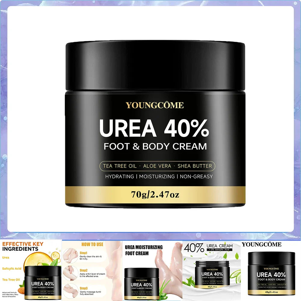 Urea 40% Foot Cream – Dry Cracked Heel & Skin Repair | YOUNGCOME