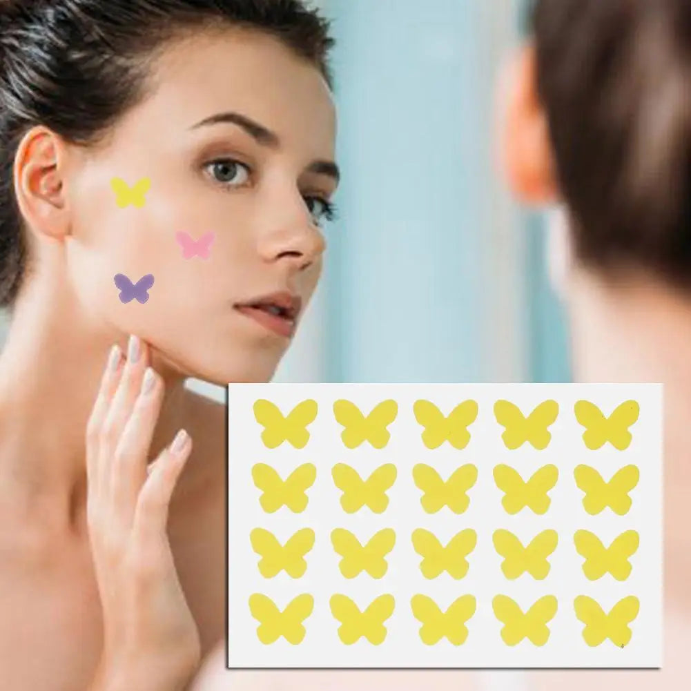 Butterfly Pimple Patches 20pc – Colorful Invisible Spot Cover