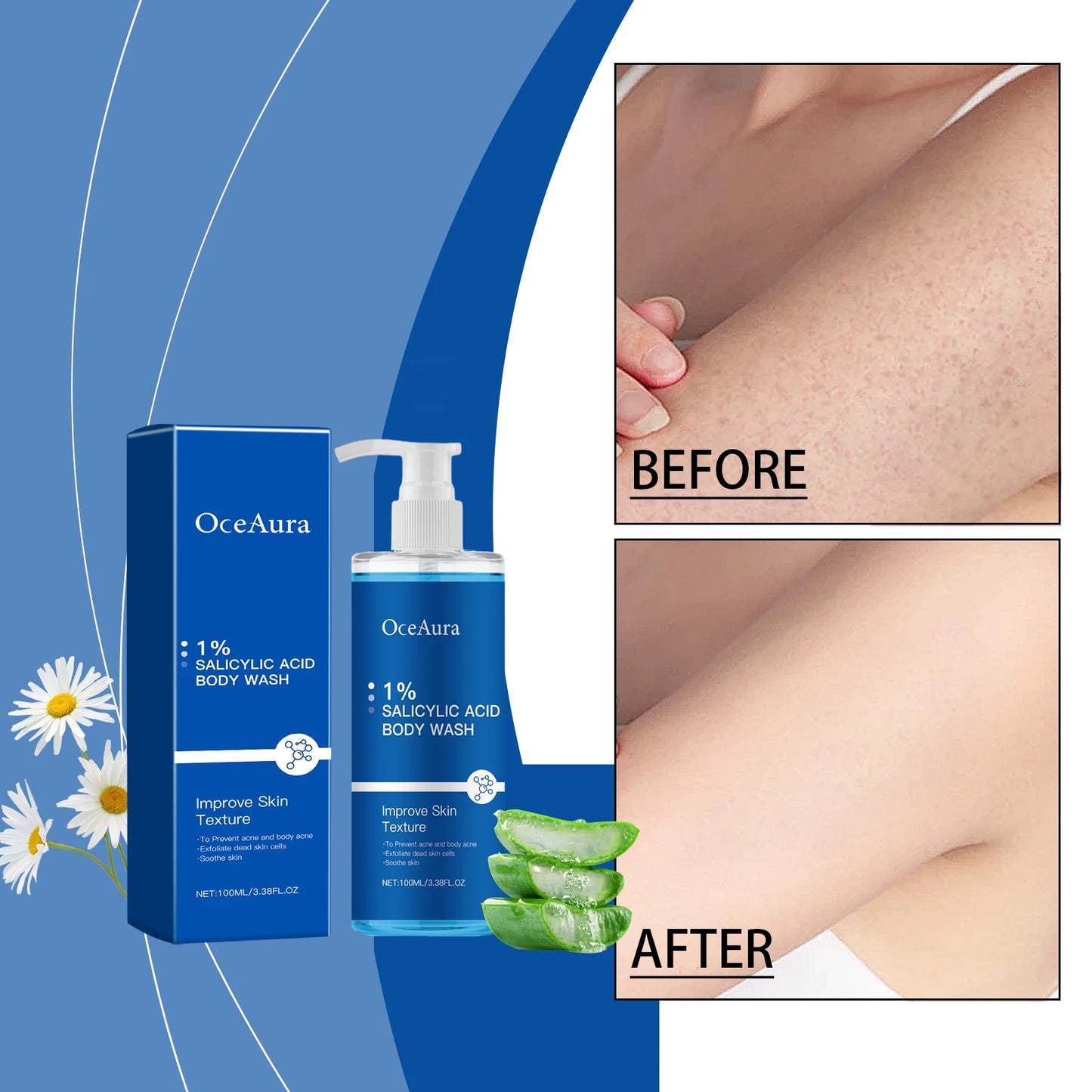 OceAura Salicylic Acid Body Wash – Exfoliate & Clear Skin