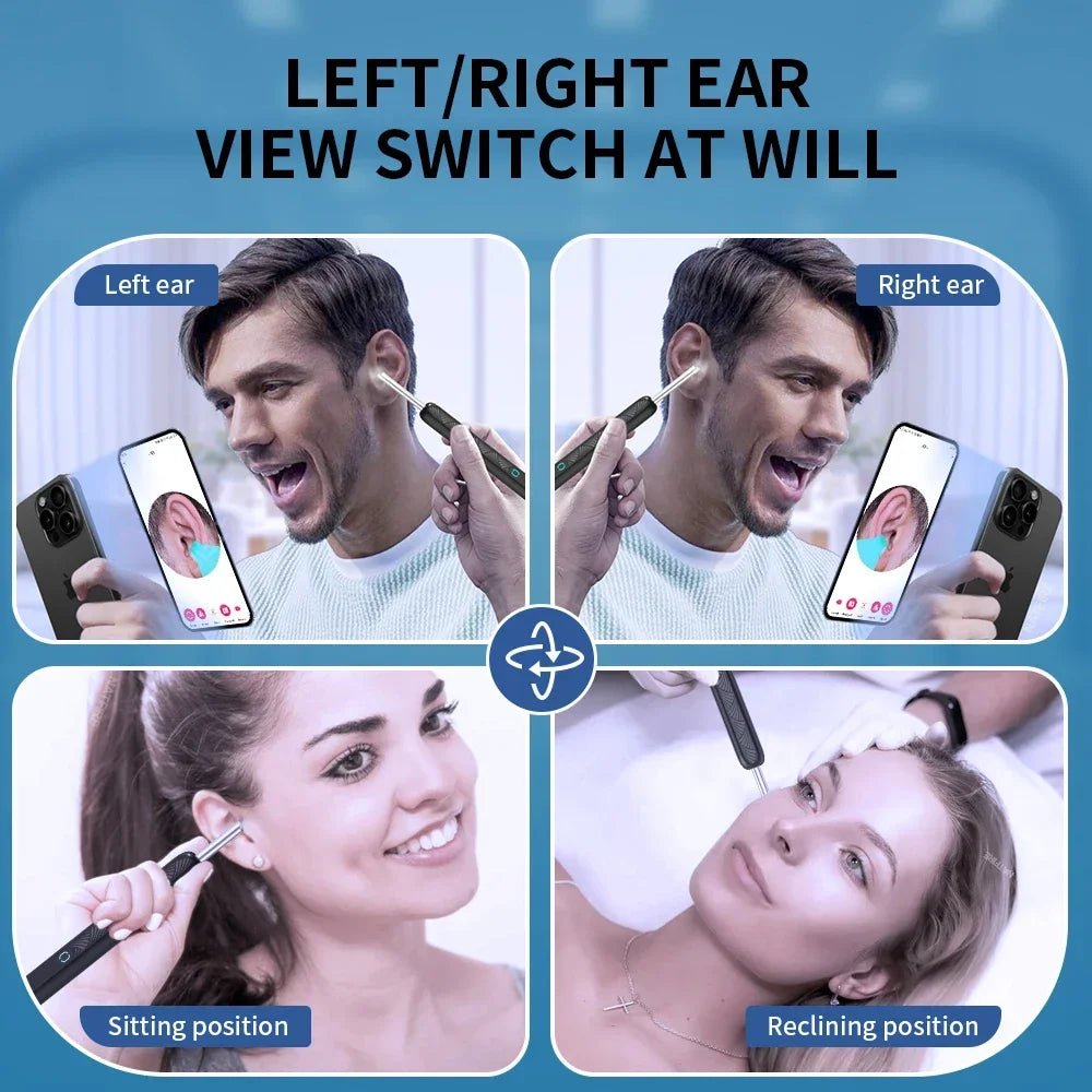 Visual Ear Wax Cleaner with Camera Safe Earwax Removal Endoscope with 5M Camera Luminous Otoscope Ear Cleaning Tools Ear Care Peaceful Pleasures Health and Wellness