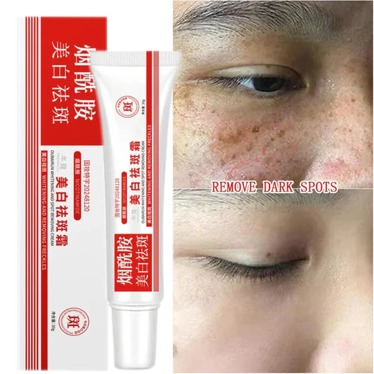 Niacinamide Brightening Cream – Fade Dark Spots 30g Brightening Face Cream Oasis Select Default Title