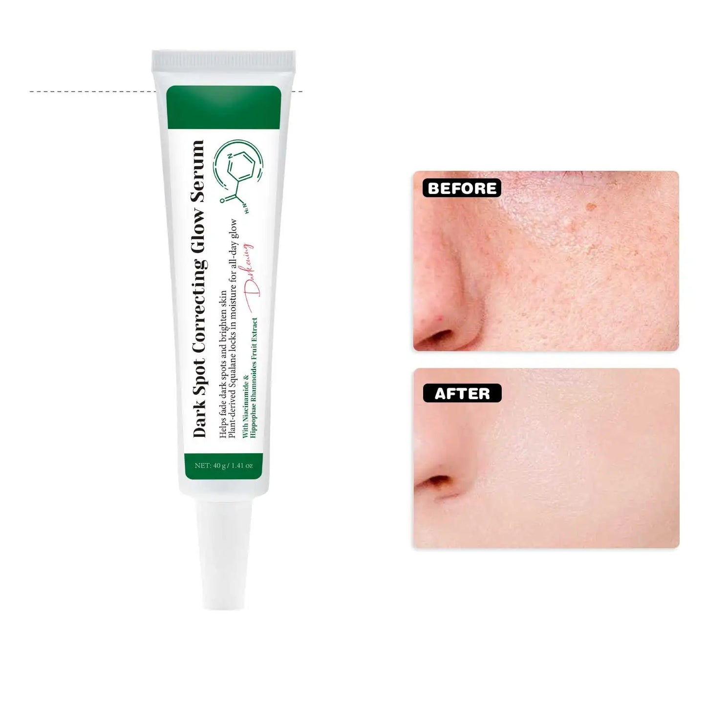 Dark Spot Correcting Glow Serum Brighten Skin Tone 5% Niacinamide Dark Spot Remover Skin Care Serum for Face 40g Peaceful Pleasures Health and Wellness