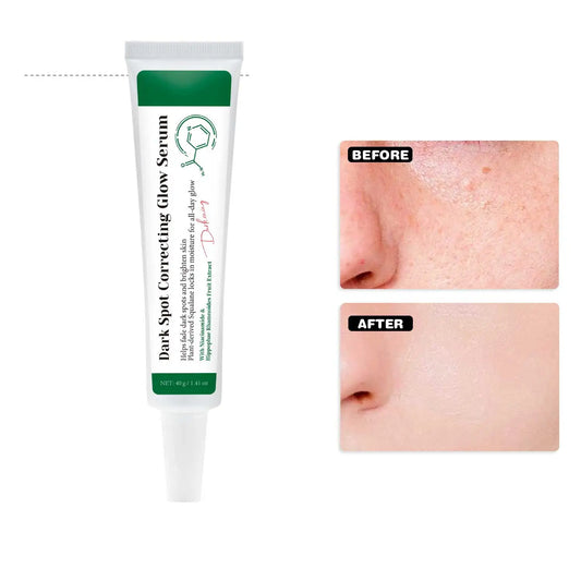 Dark Spot Correcting Glow Serum Brighten Skin Tone 5% Niacinamide Dark Spot Remover Skin Care Serum for Face 40g Peaceful Pleasures Health and Wellness