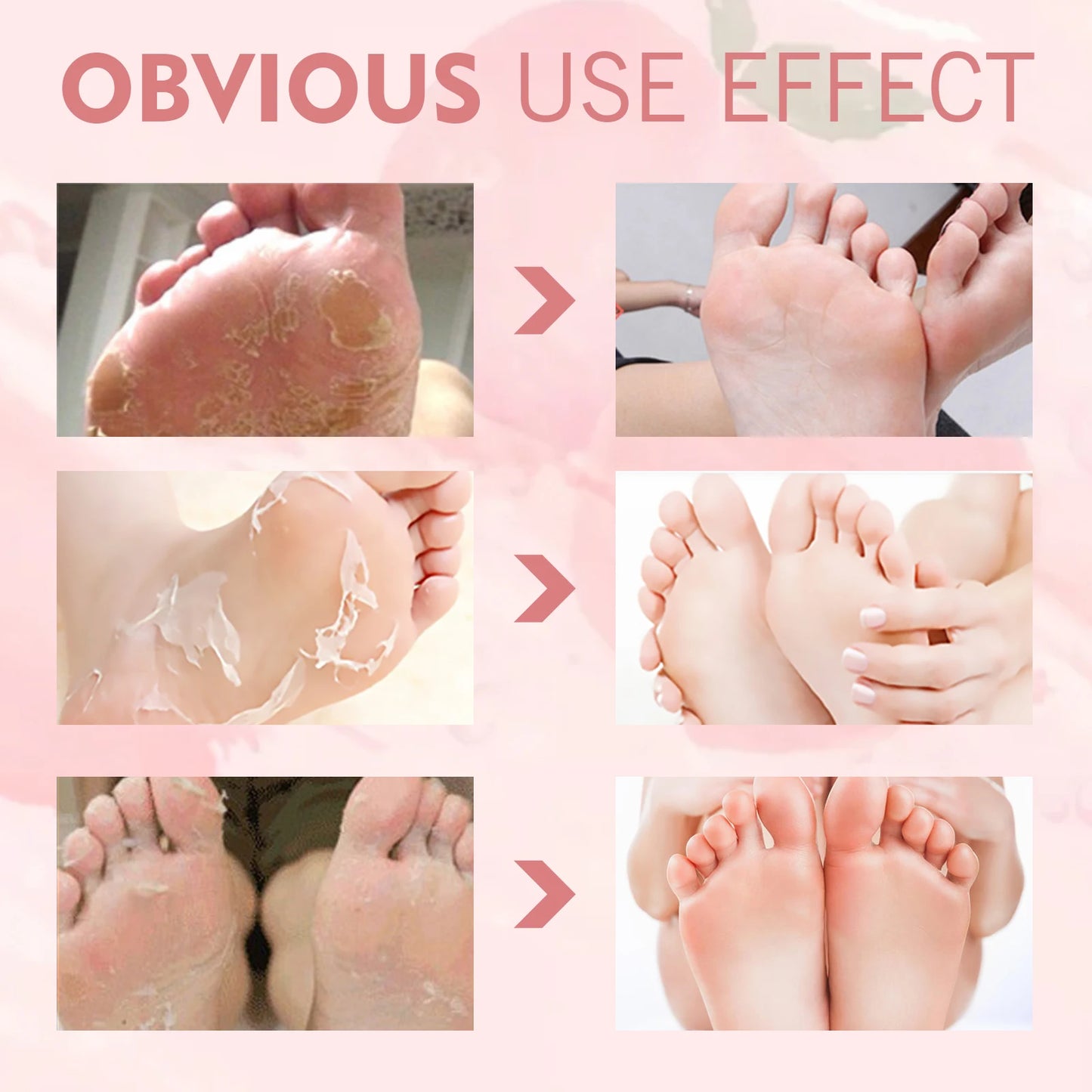 Peach Exfoliating Foot Mask Booties | Dead Skin Removal Socks