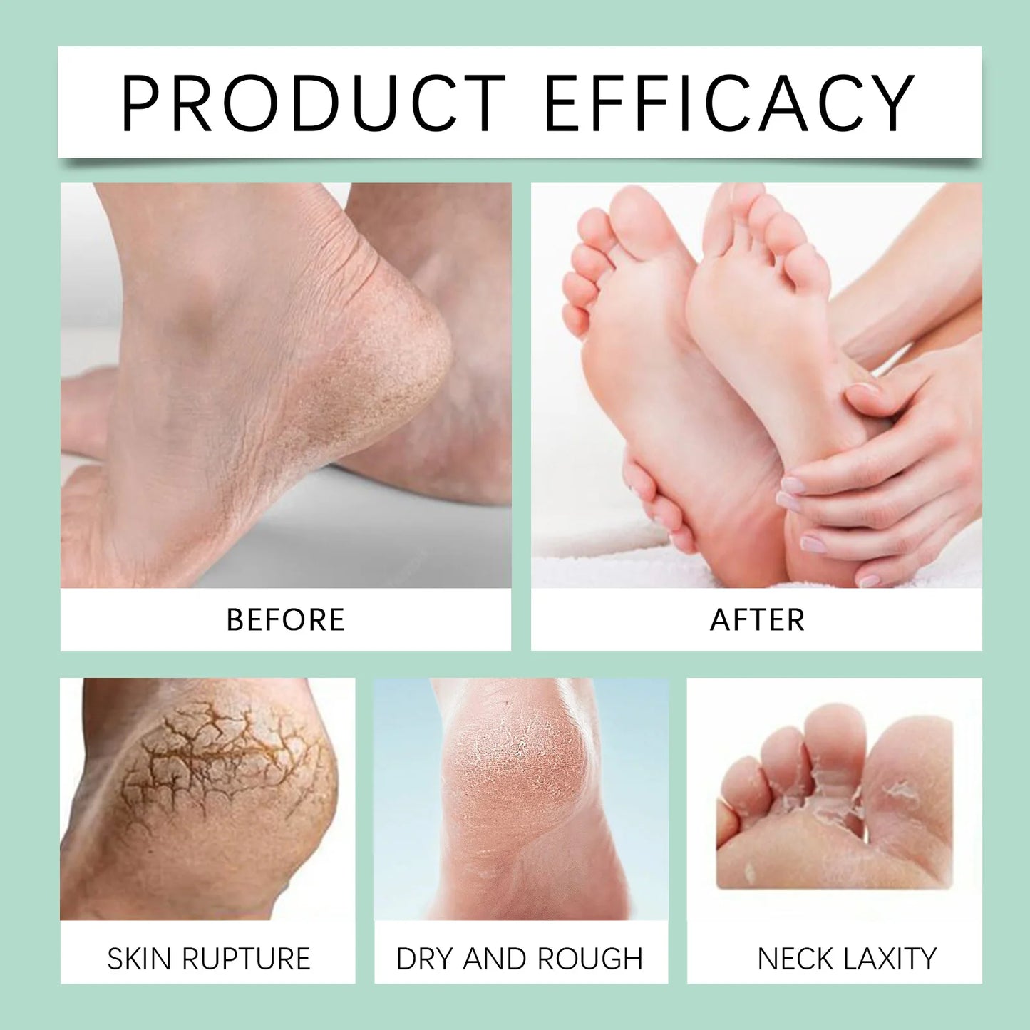 OceAura Foot Exfoliating Softening Spray 100ml | Callus Remover