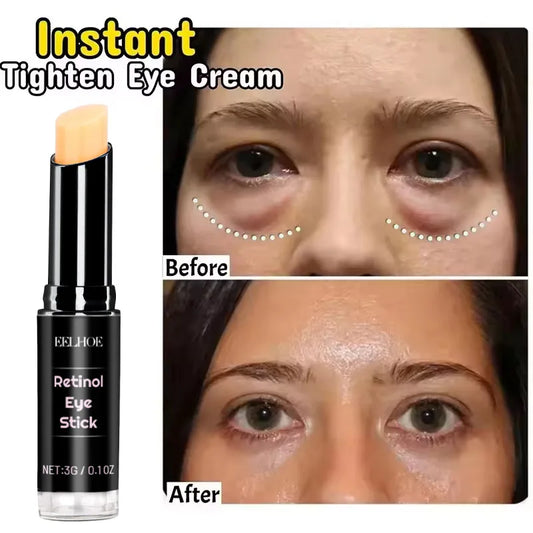 Eelhoe Retinol Eye Cream Stick – Firm, Brighten & Hydrate Retinol Eye Cream Oasis Select