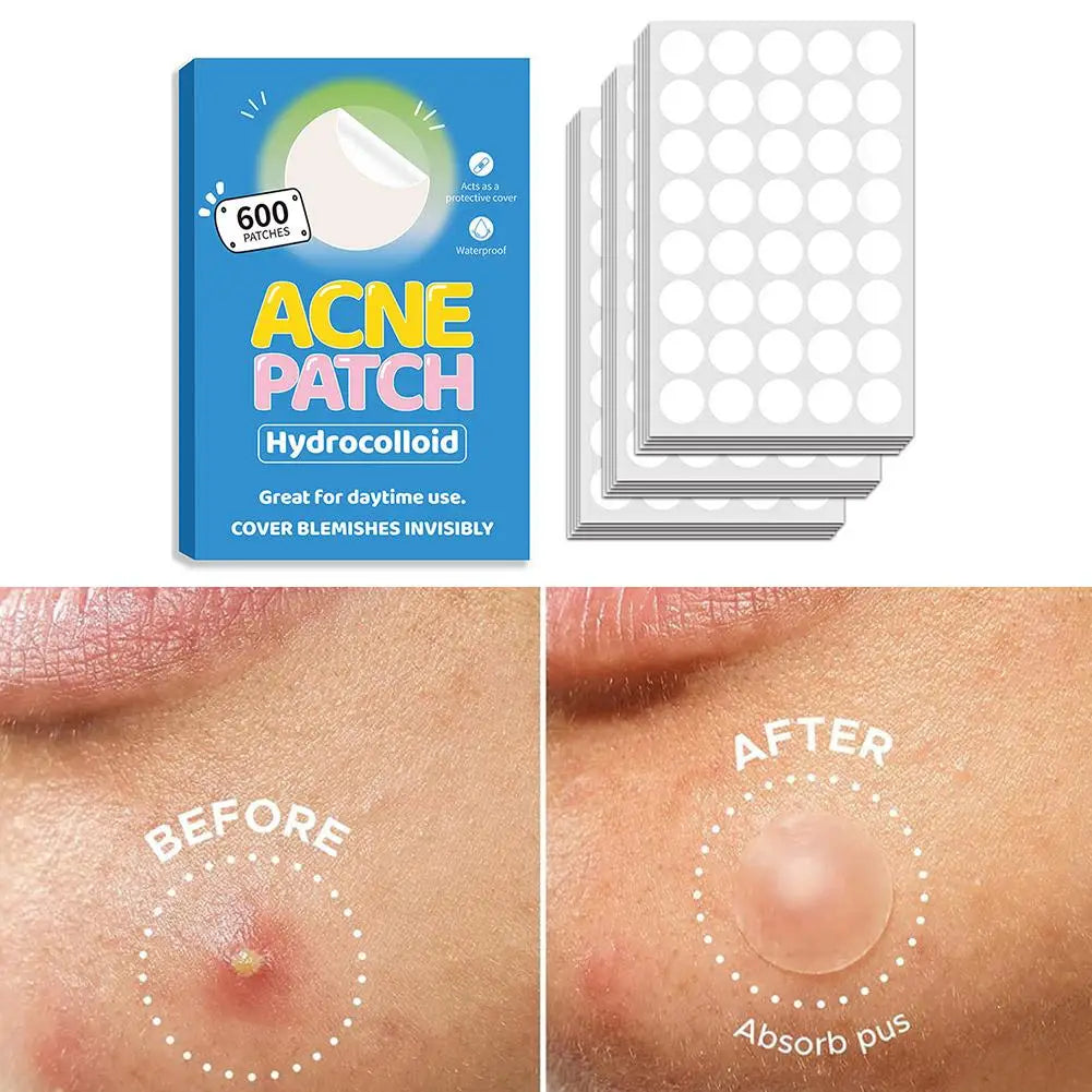 Invisible Hydrocolloid Acne Patches – Multi-Shape Spot Stickers for Face | 40–720 Pcs Peaceful Pleasures Health and Wellness