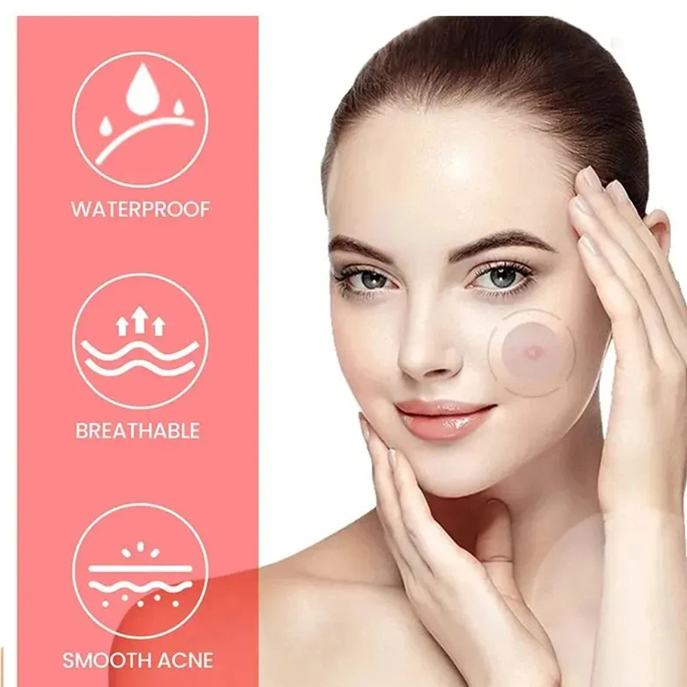 200pcs Acne Pimple Repair Patches | Fade Blemishes & Cover Spots