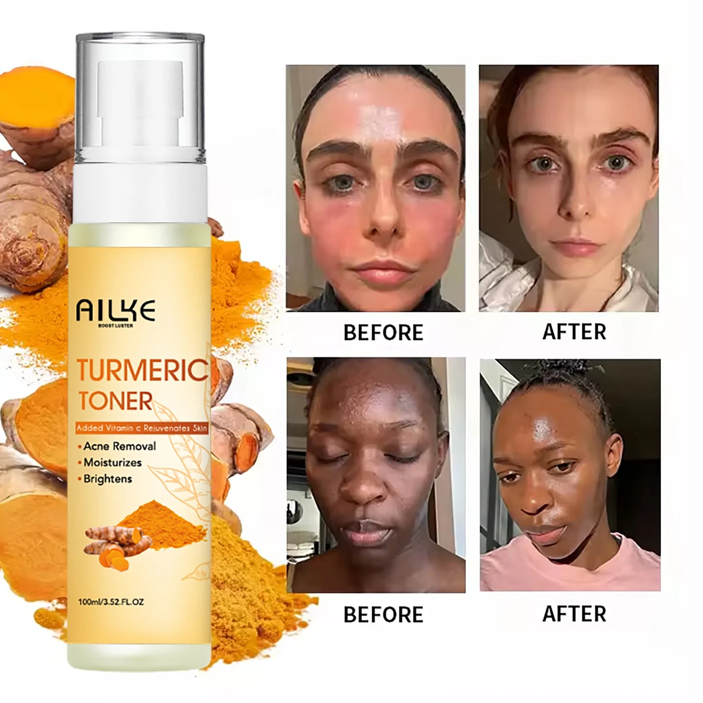 AILKE Organic Turmeric & Vitamin C Face Toner 100ml