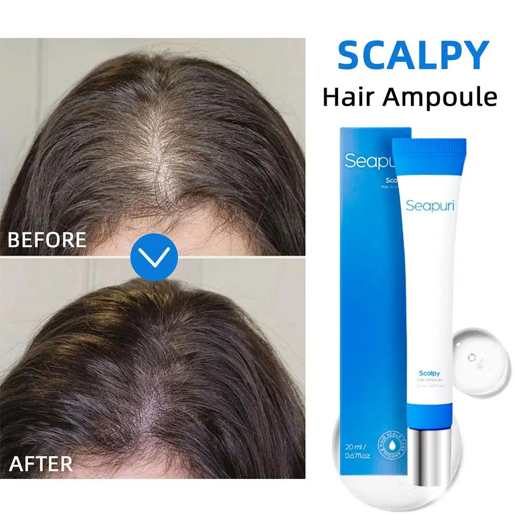 Scalp Hair Serum Rollerball – Anti-Frizz & Hair Growth