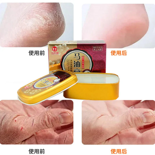 Jintai Kangma Horse Oil Cream – Hand & Foot Moisturizer 80g Hand & Foot Cream Oasis Select Default Title