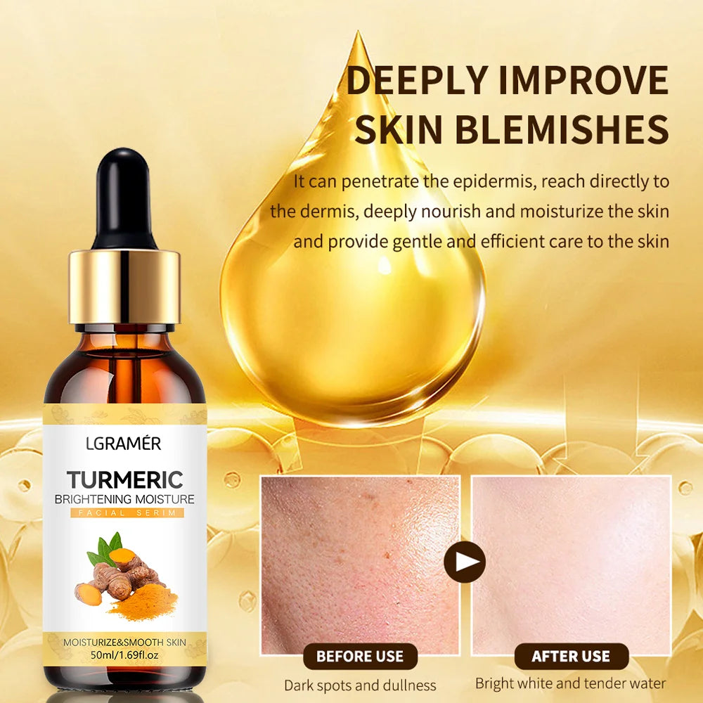 LGRAMER Turmeric Serum – Fade Dark Spots & Brighten Skin