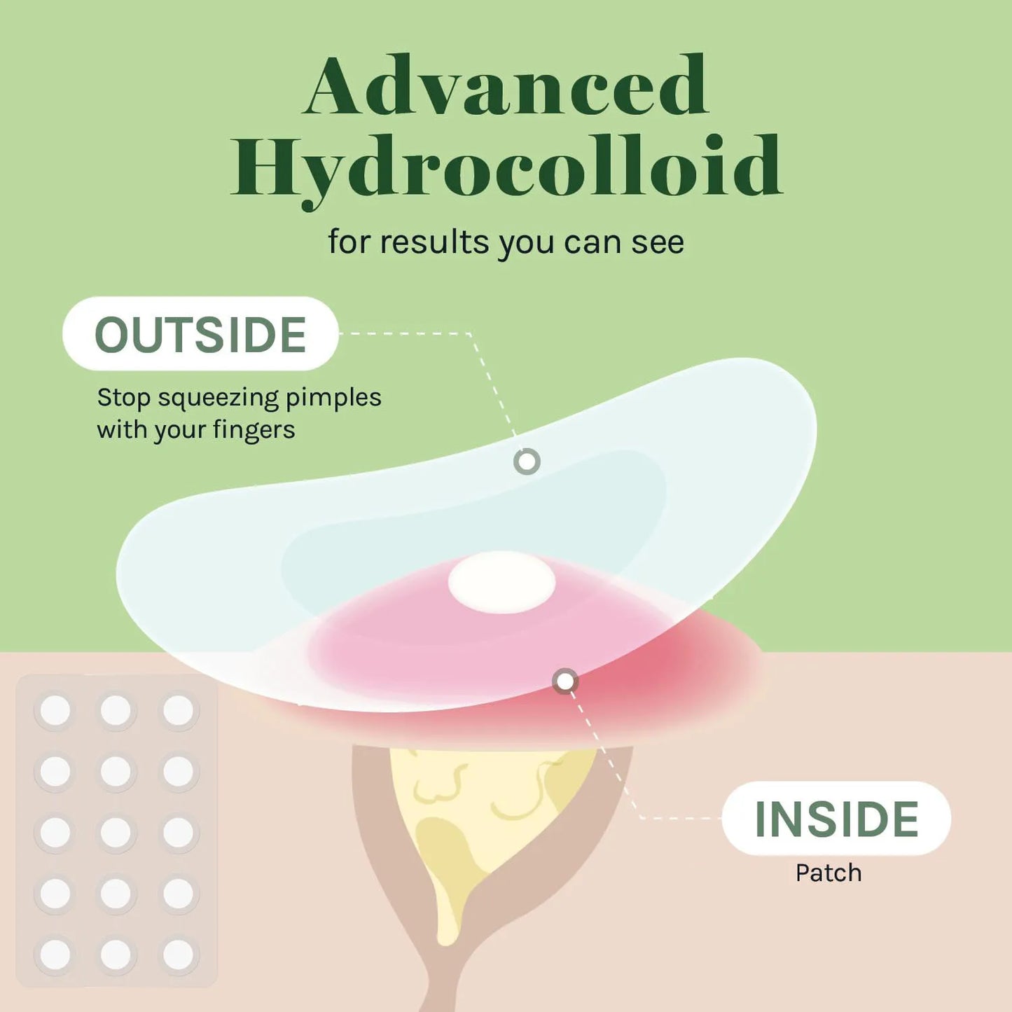 Invisible Waterproof Hydrocolloid Acne Patches – All Skin Types