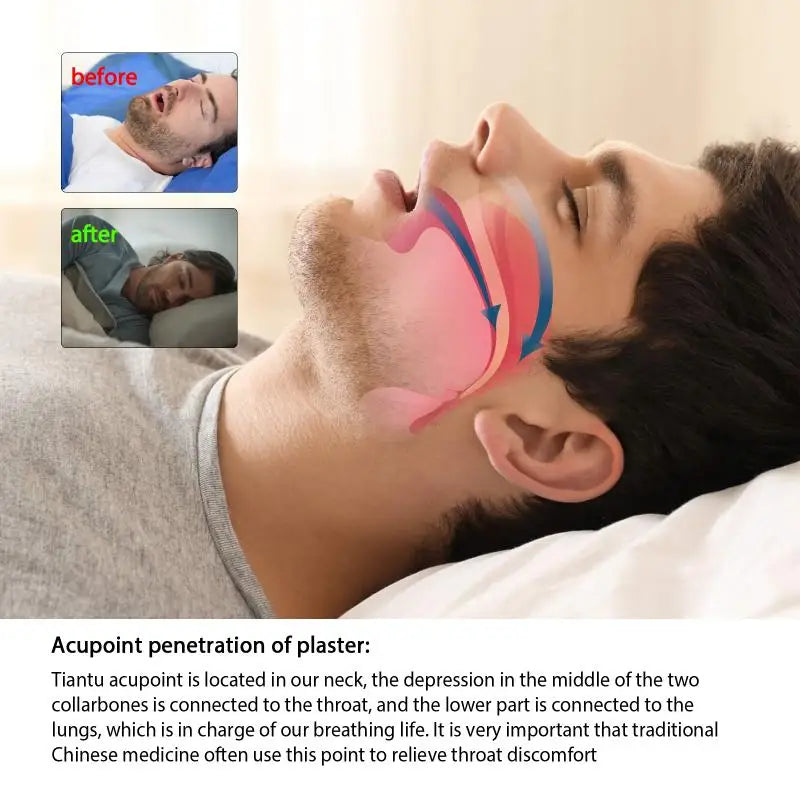 12Pcs Anti-Snoring Patches Acupoint Prevent Snoring Fatigue Night Sleep Quiet Nose Strips Peaceful Pleasures Health and Wellness