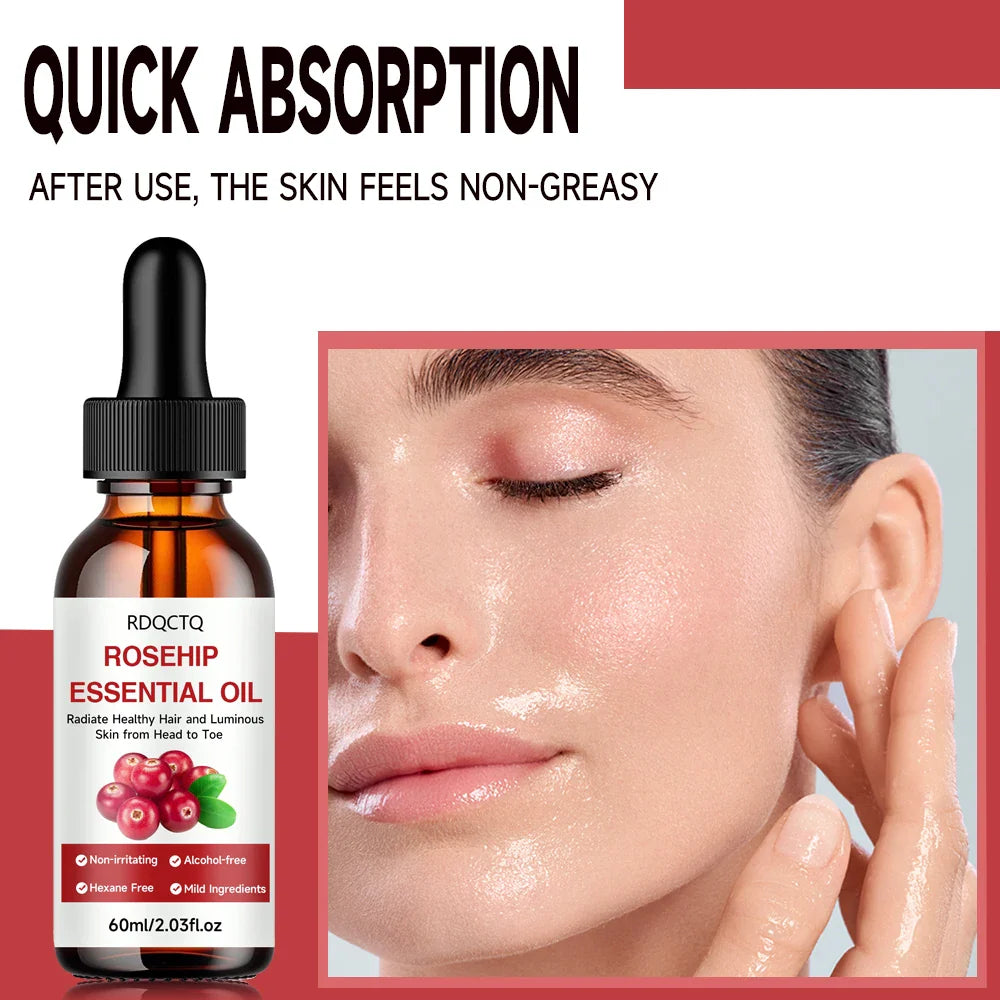 Rosehip Oil for Hair & Skin – Pure Natural Moisturizing Oil