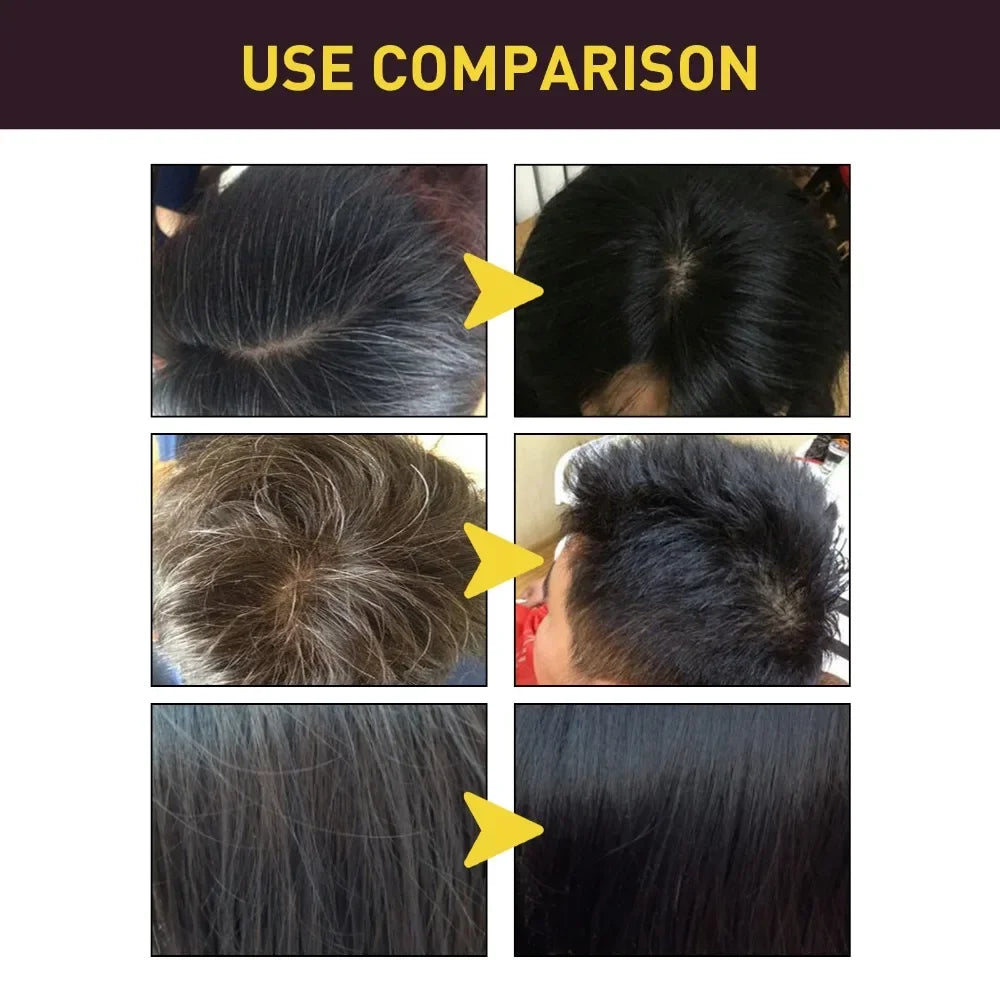 100ml Natural Herbal Hair Dye Shampoo 3 in 1 Hair Color Shampoo for Gary Hair Dark Brown Black for Women & Men Grey Coverage Peaceful Pleasures Health and Wellness