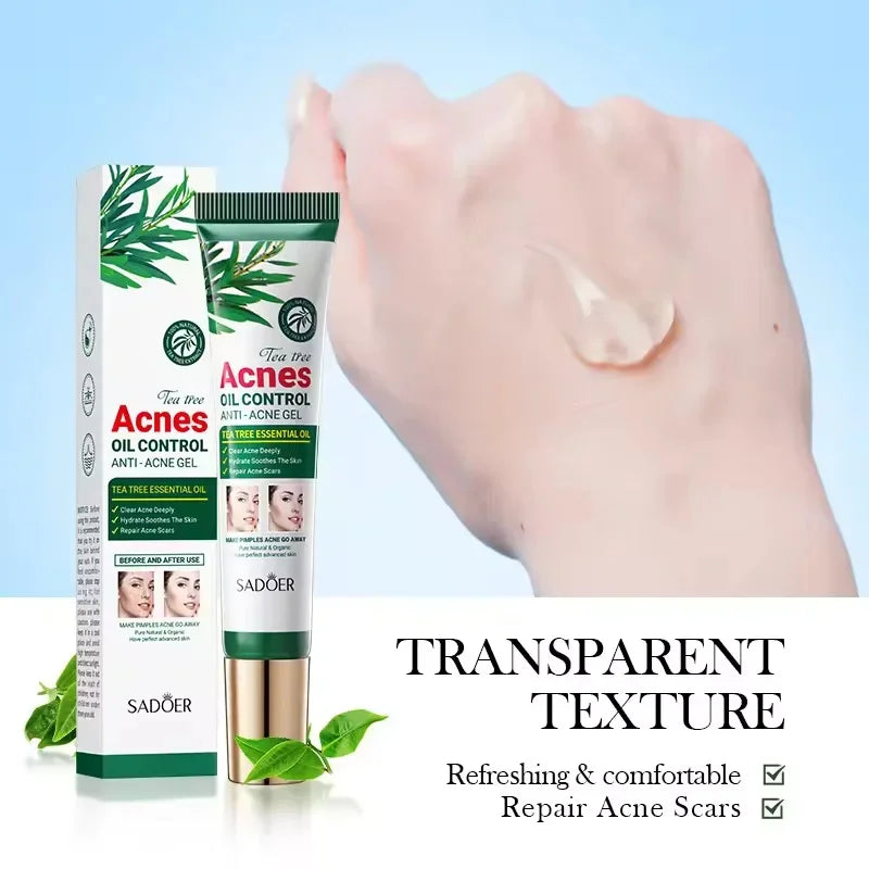 Tea Tree Acne Removing Cream Facial Mild Moisturizing Oil Control Acne Removing Facial Gel Eliminate Acne Pimples Beauty Health Peaceful Pleasures Health and Wellness