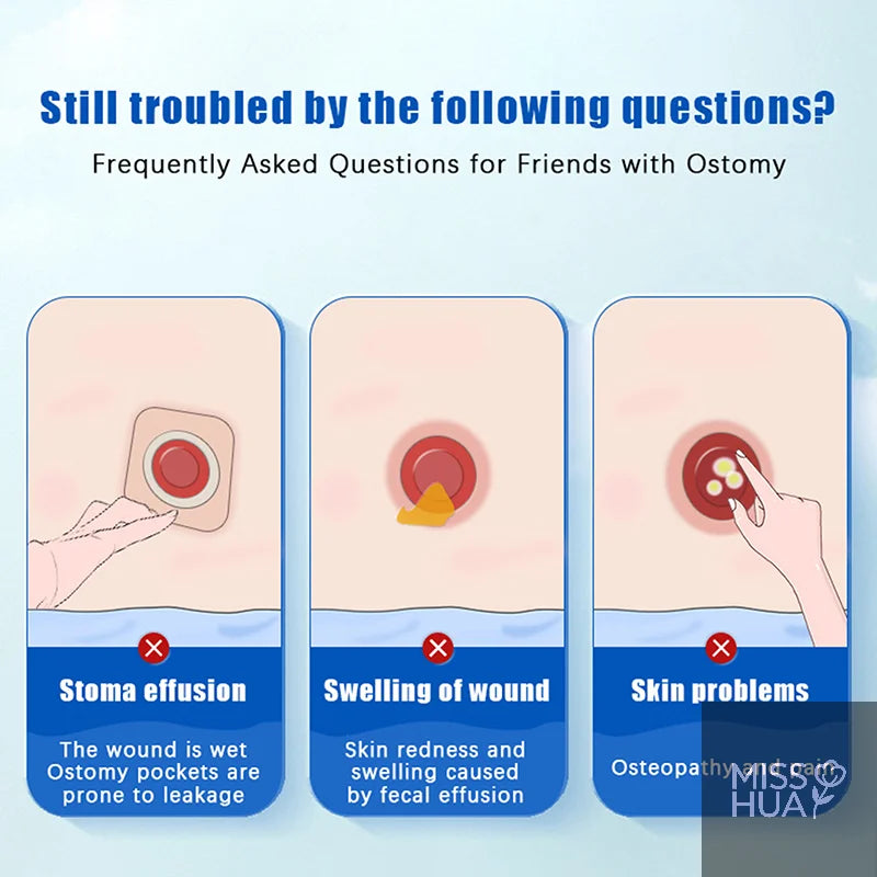 Ostomy Protective Skin Care Powder | Stoma Barrier Powder