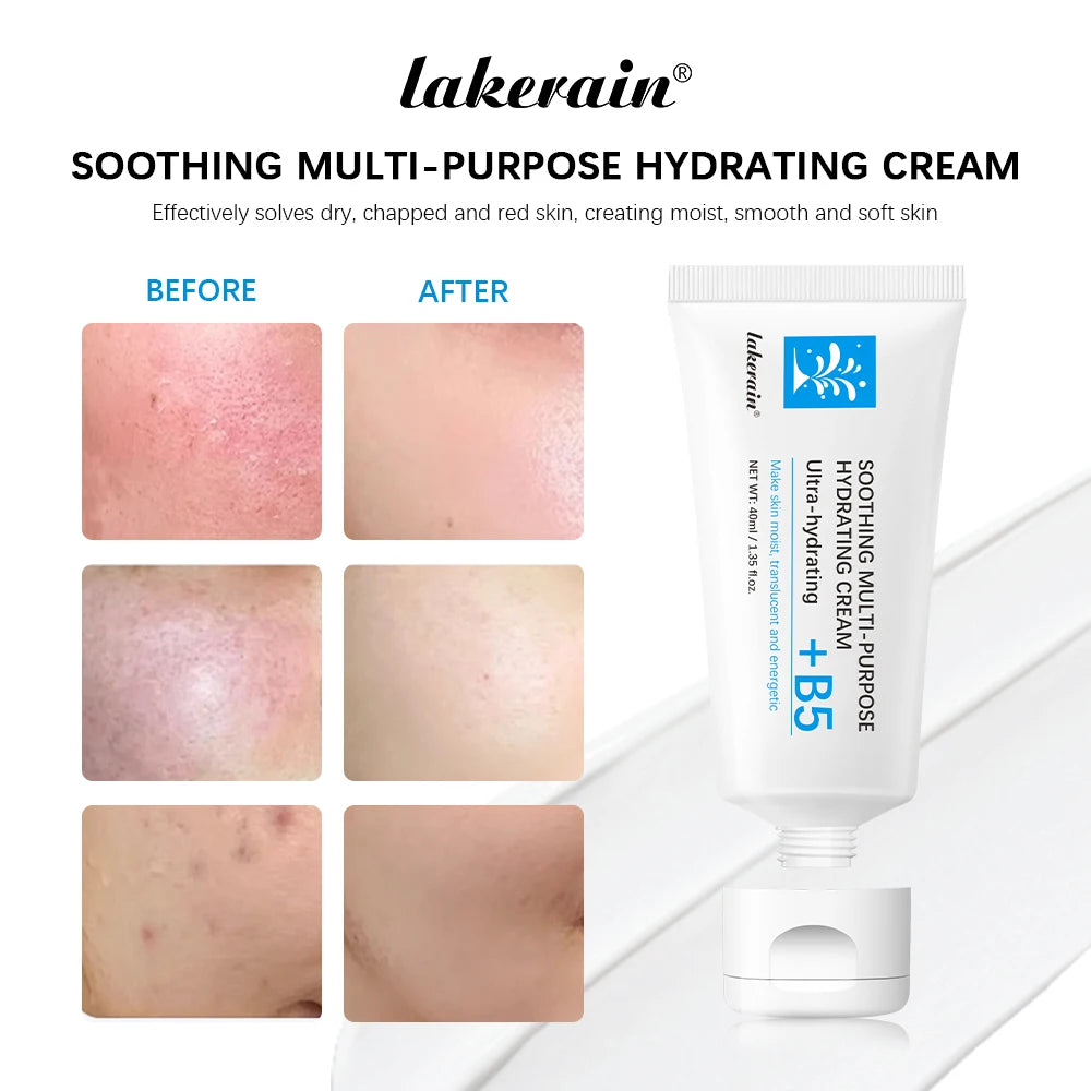 B5 Repair Cream Moisturizing Hydrating Effectively Solves Dry Chapped And Red Skin Nourishes Improve Repair Sunscreen Cream Peaceful Pleasures Health and Wellness