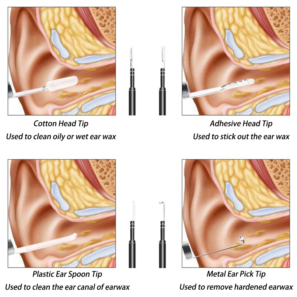 Smart Visual Medico Otoscopio Ear Cleaner Ear Endoscope Earpick Camera Ear Wax Remover Tool Ear Picker Ear Stick beleza e saude Peaceful Pleasures Health and Wellness