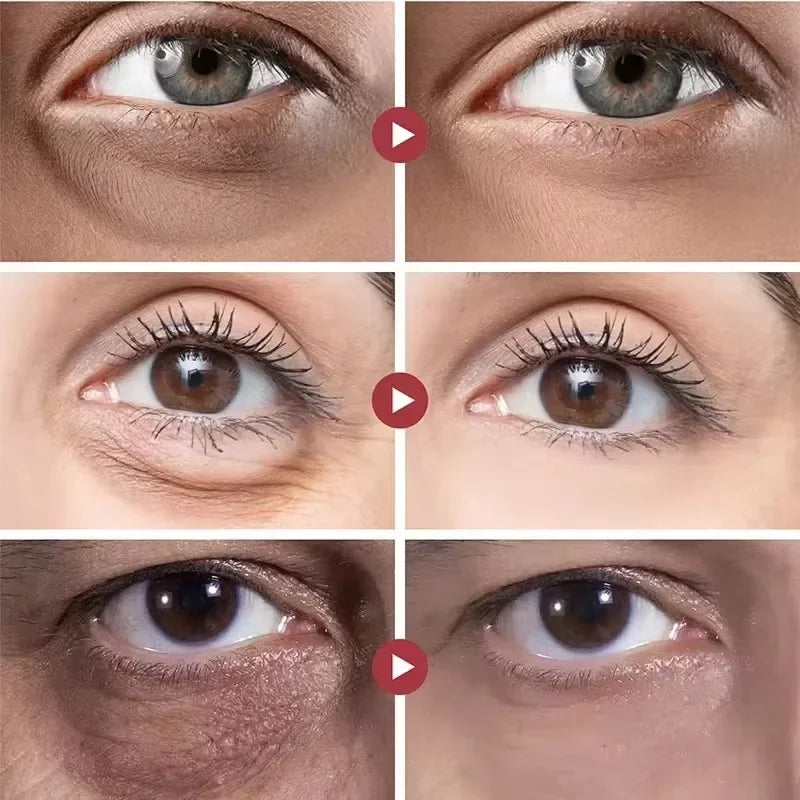 Instant Eye Bag Removal Cream Retinol Anti-Wrinkle Fade Fine Lines Firming Skin Anti Dark Circle Puffiness Brighten Eye Care Peaceful Pleasures Health and Wellness