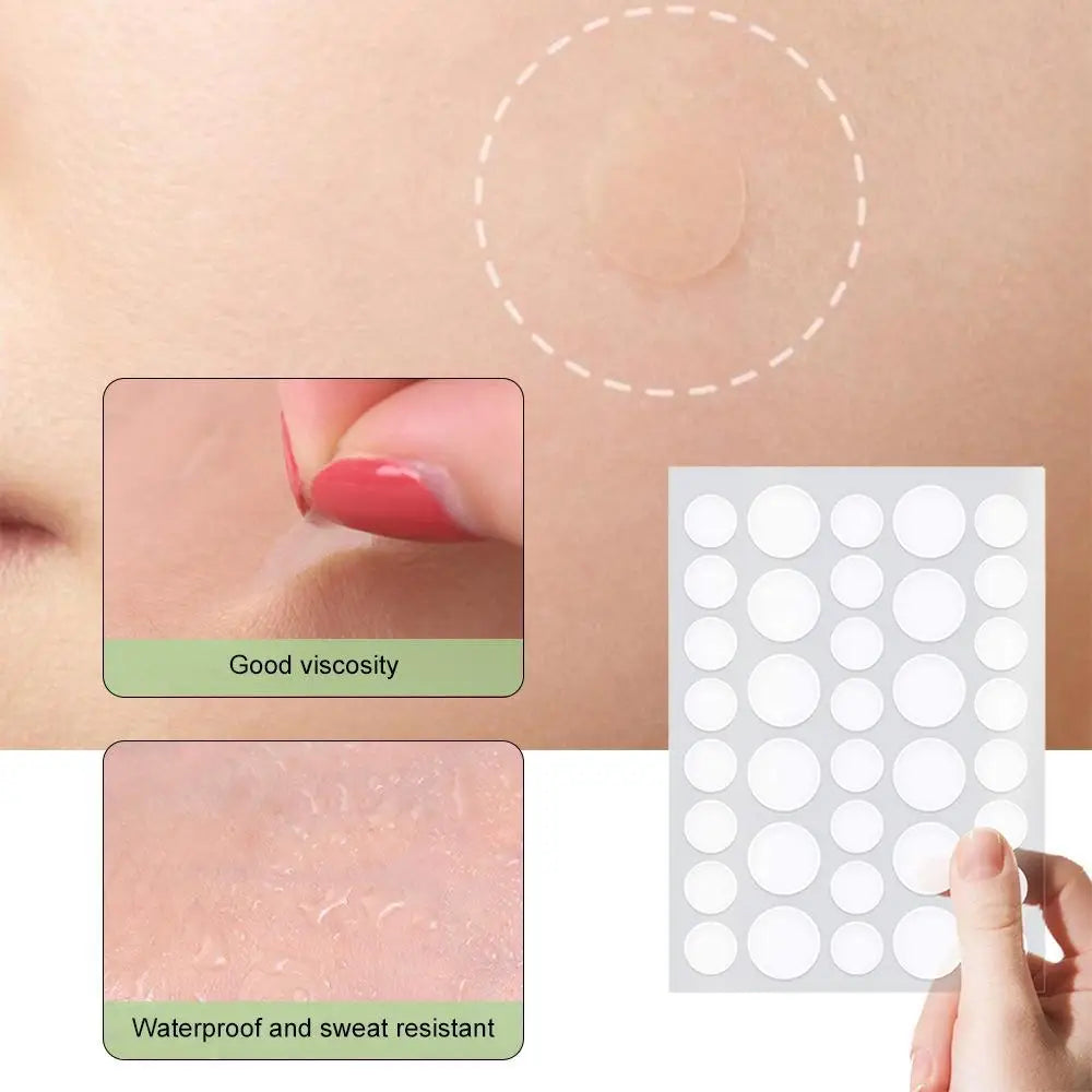 Invisible Pimple Patches with Tea Tree Oil – Hydrocolloid Acne Patches & Blemish Dots (72 or 288 Count) Peaceful Pleasures Health and Wellness