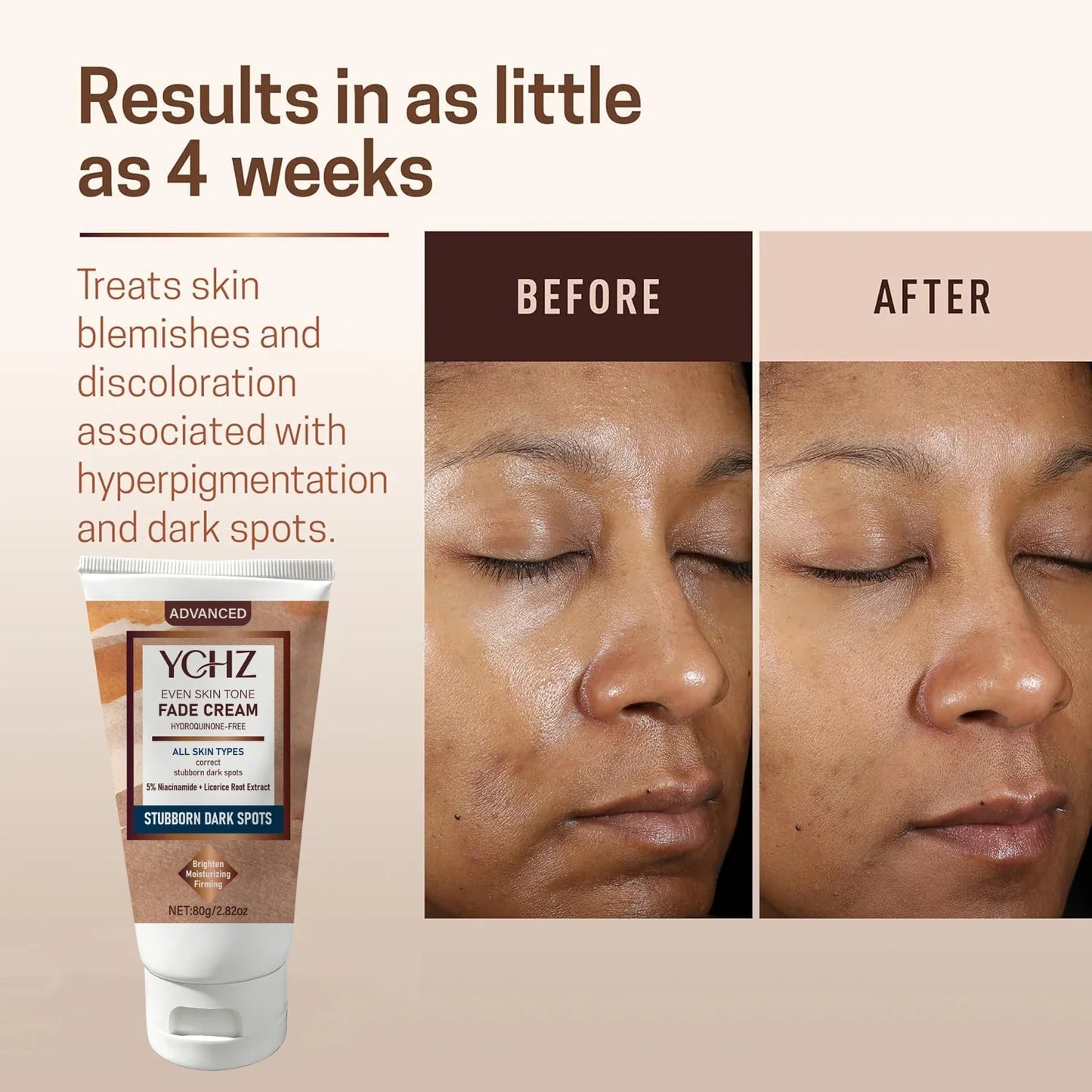 Niacinamide Dark Spot Brightening Cream – Even Skin Tone | 80g