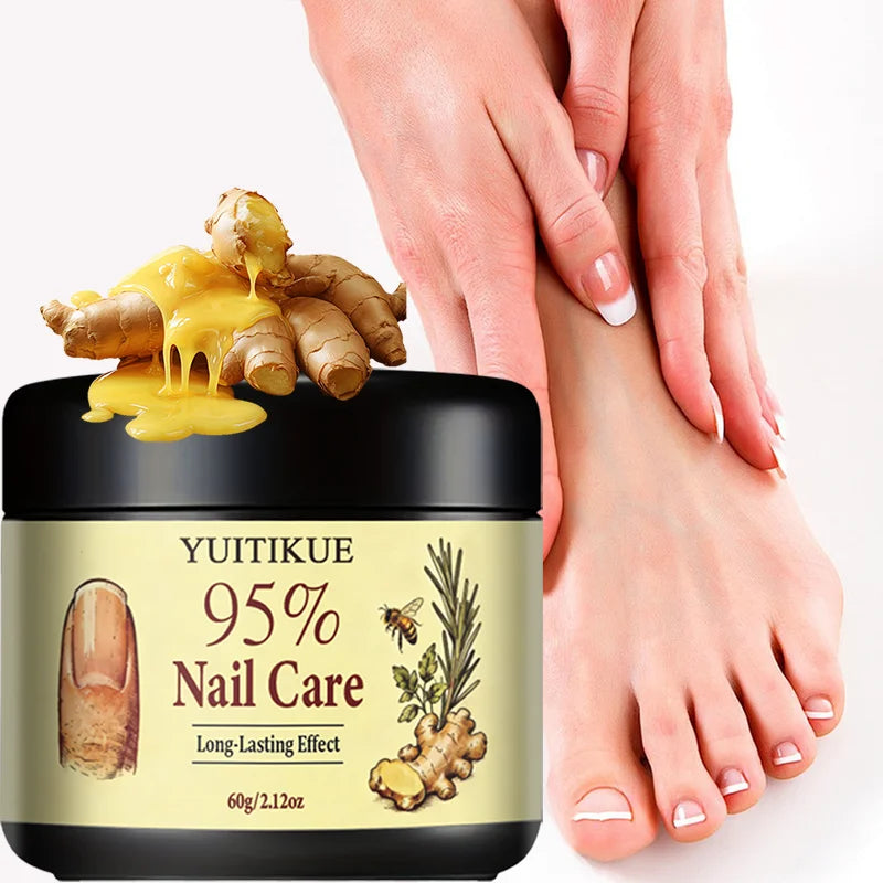 Yuitikue 95% Nail Care Cream, 60g Long-Lasting Nail Repair Cream for Strengthening Nails & Improving Nail Health Peaceful Pleasures Health and Wellness