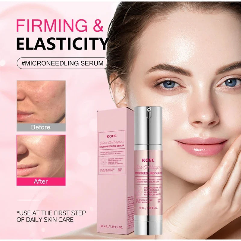 Centella Asiatica Microneedle Serum – Hydrate, Firm & Brighten