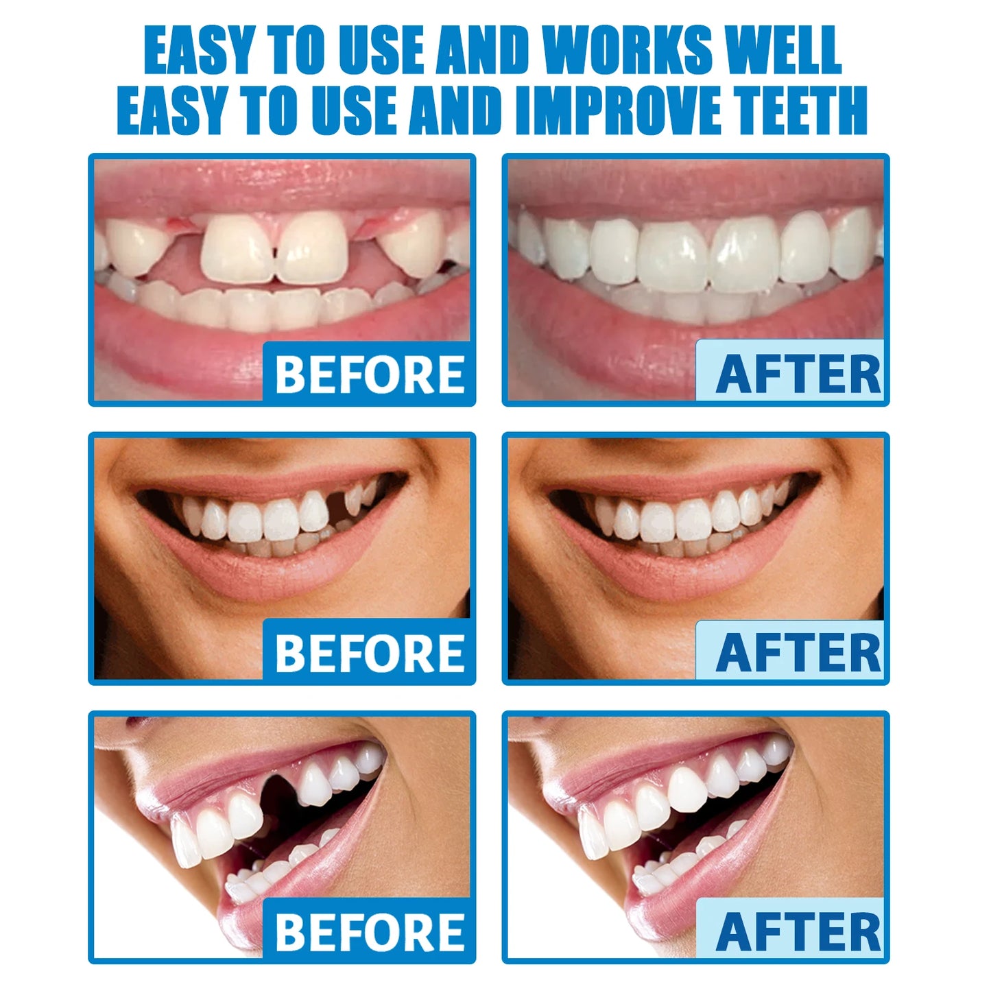 Temporary Tooth Repair Kit – DIY Dental Restoration Beads