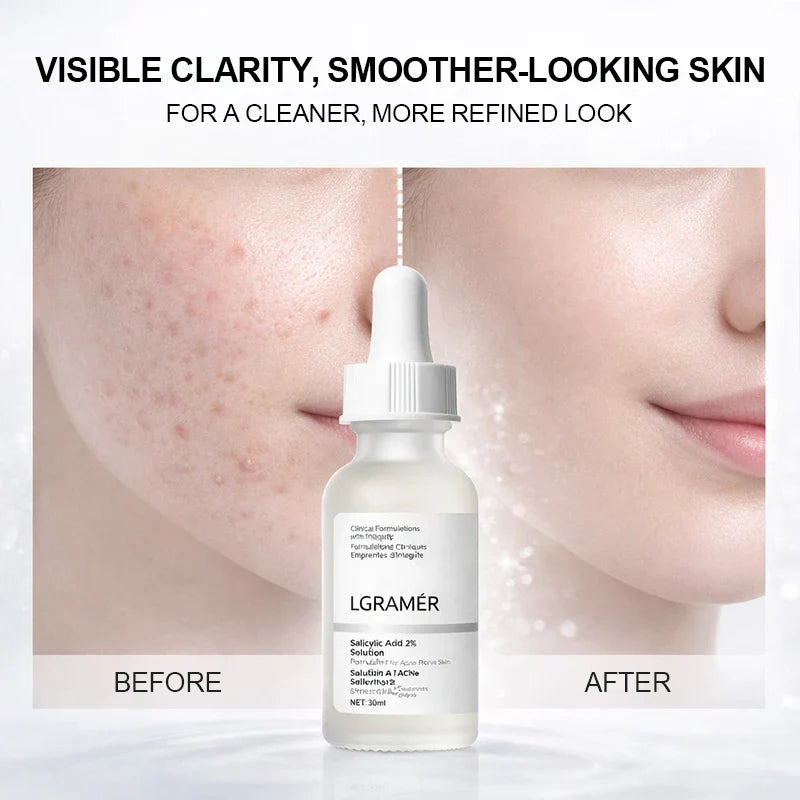 LGRAMER 2% Salicylic Acid Serum – Pore Cleansing & Hydration