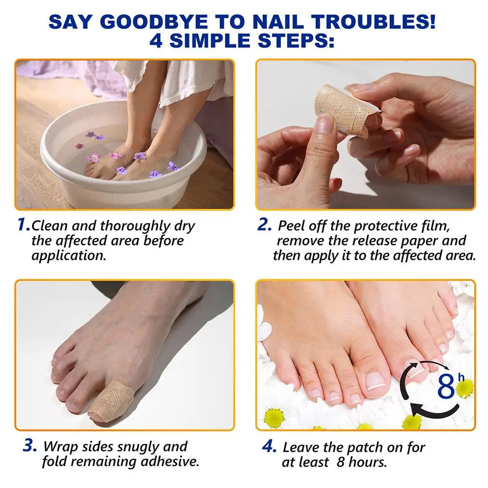 21pc Gray Toe Nail Sticker Fungal Nail Repair Patch Ingrown Correction Sticker Toenail Care Paronychia Nail Treatment Patch CarE Peaceful Pleasures Health and Wellness