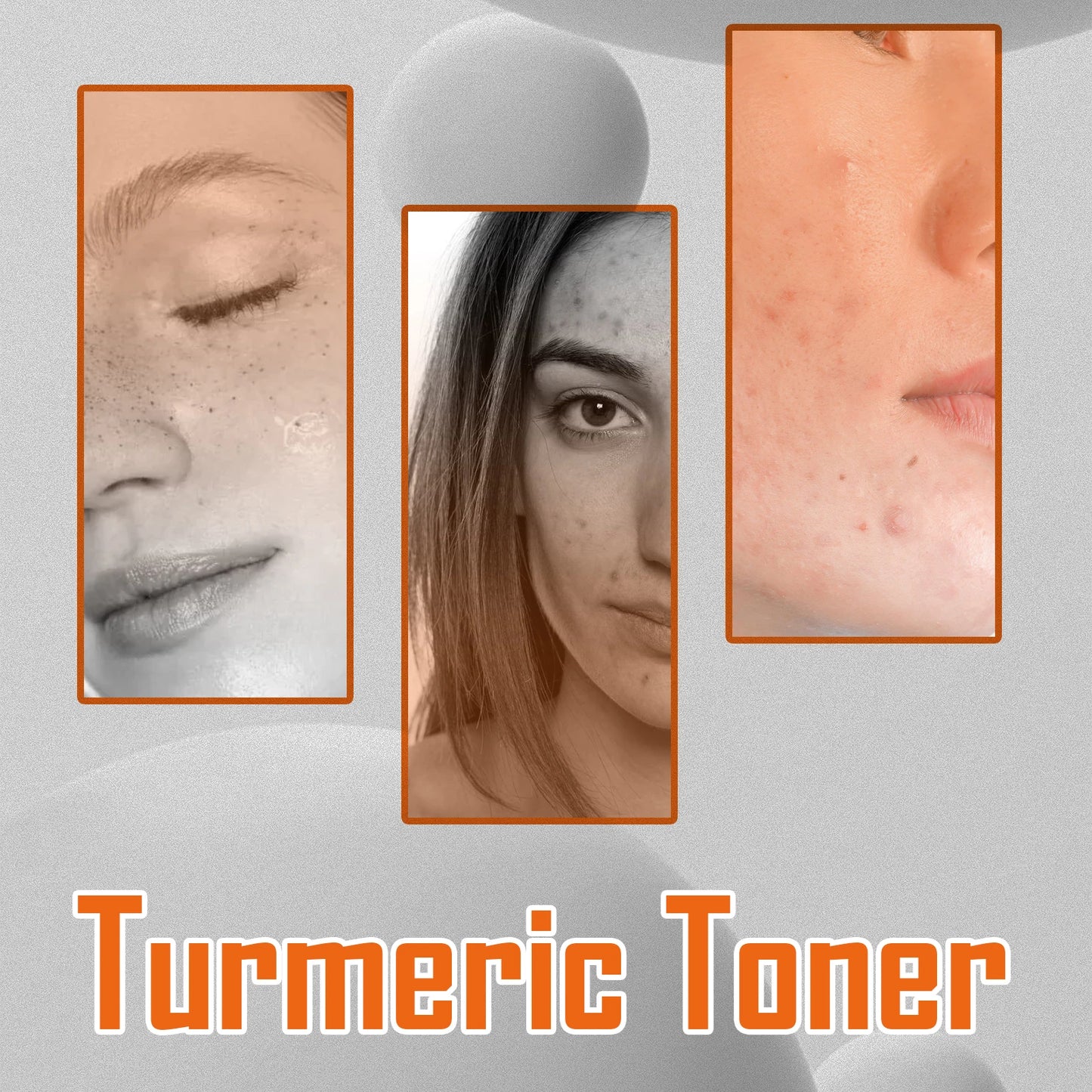 Turmeric Face Toner – Dark Spot Corrector & Brightening