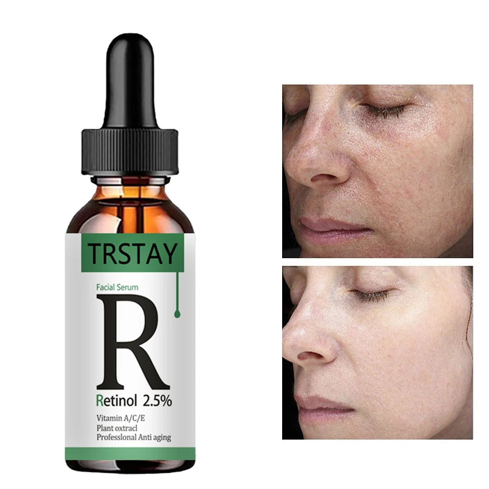Retinol 2.5% Vitamin C / A Facial Anti Wrinkle Serum Remove Dark Spots Collagen Serum Anti Aging Essence Whitening Face Serum Peaceful Pleasures Health and Wellness