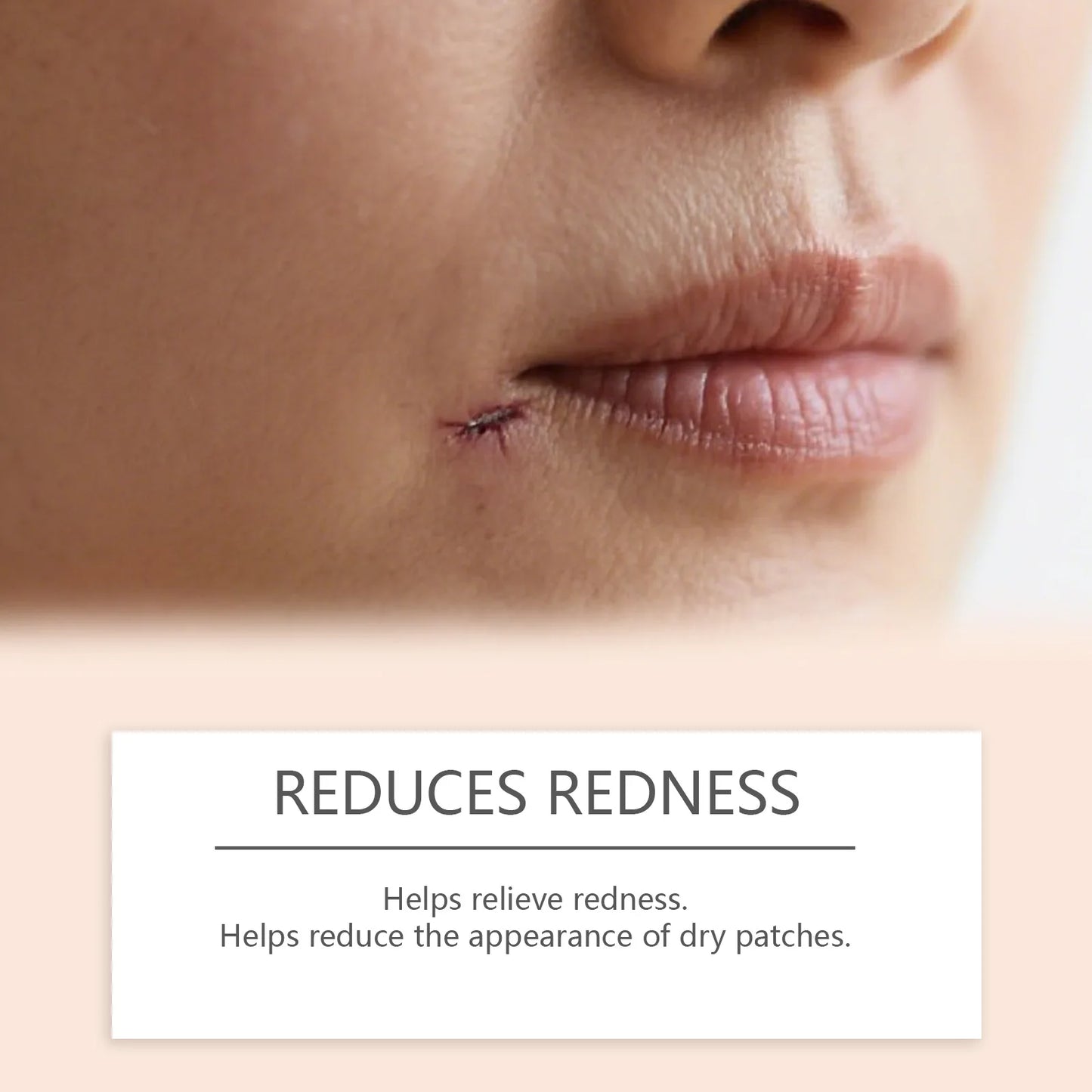 Silicone Scar Stick Acne Scar Reducing Redness Repair Blemishes Mild Formula Support Skin's Natural Repair Whitening Skin Care Peaceful Pleasures Health and Wellness