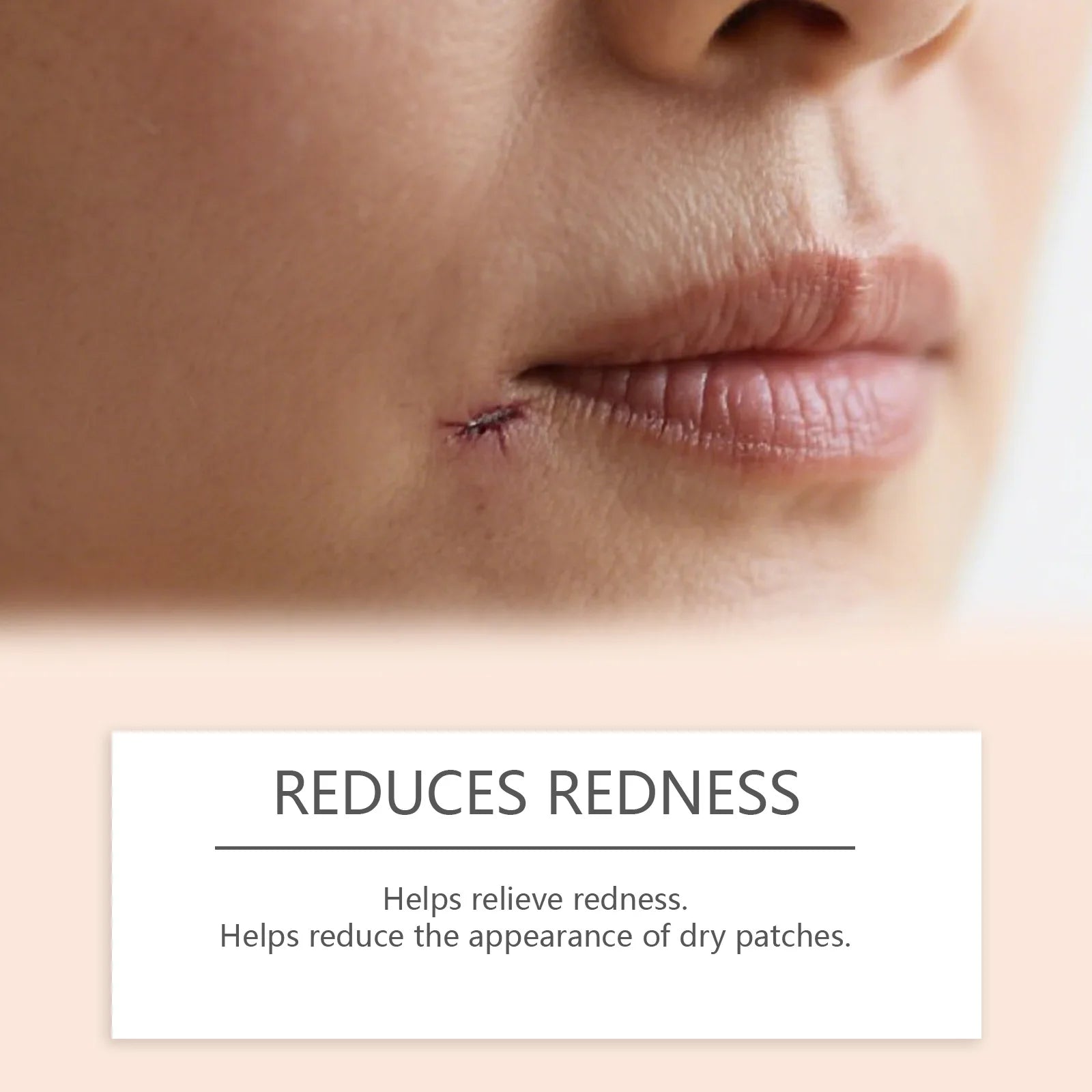 Silicone Scar Stick Acne Scar Reducing Redness Repair Blemishes Mild Formula Support Skin's Natural Repair Whitening Skin Care Peaceful Pleasures Health and Wellness