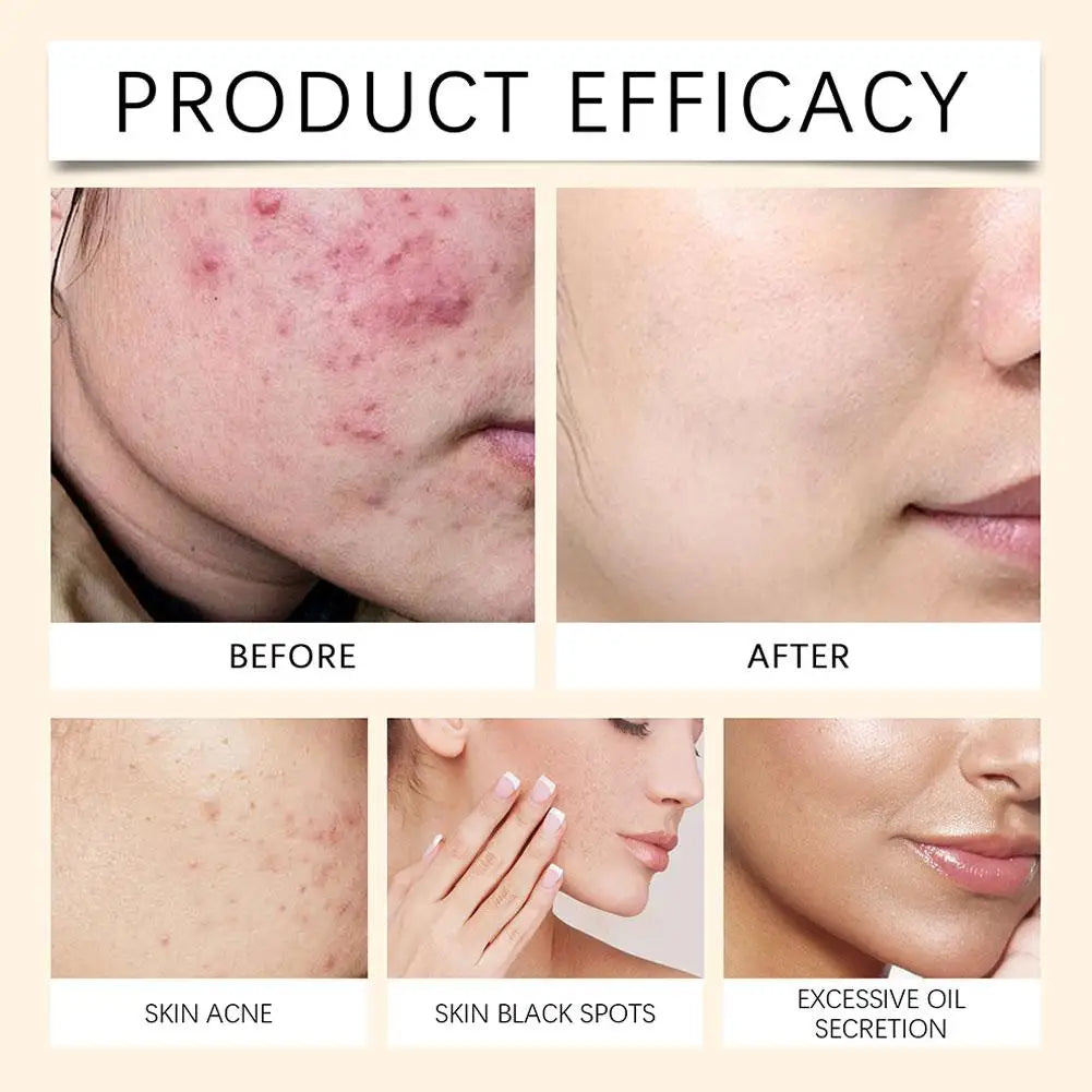 100ml Soothing Deep Moisturizing Face Spray – All Skin Types