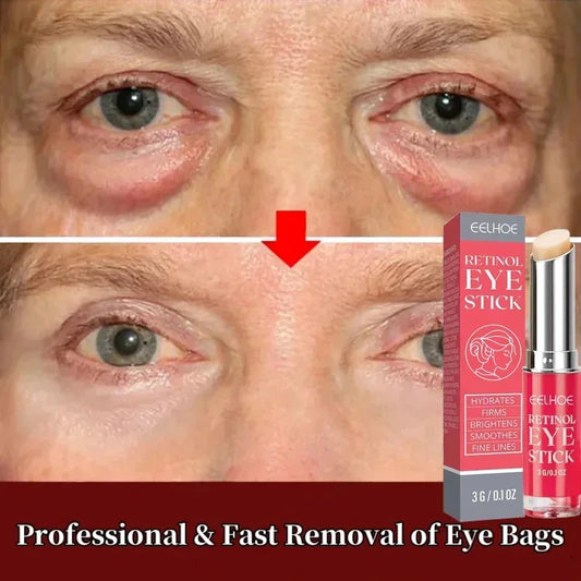 Retinol Eye Bags Removal Cream Instant Anti-Wrinkle Firming Skin Fade Fine Lines Anti Dark Circle Puffiness Brighten Eye Care Peaceful Pleasures Health and Wellness Default Title