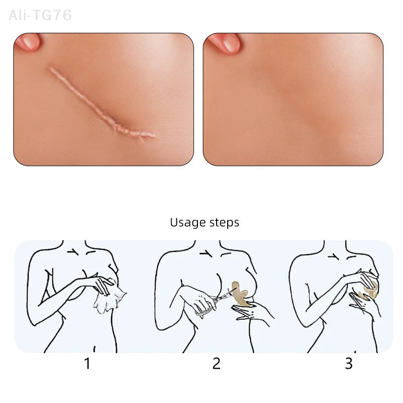 Reusable Silicone Invisible Cover Stickers – Chest & Skin Concealer