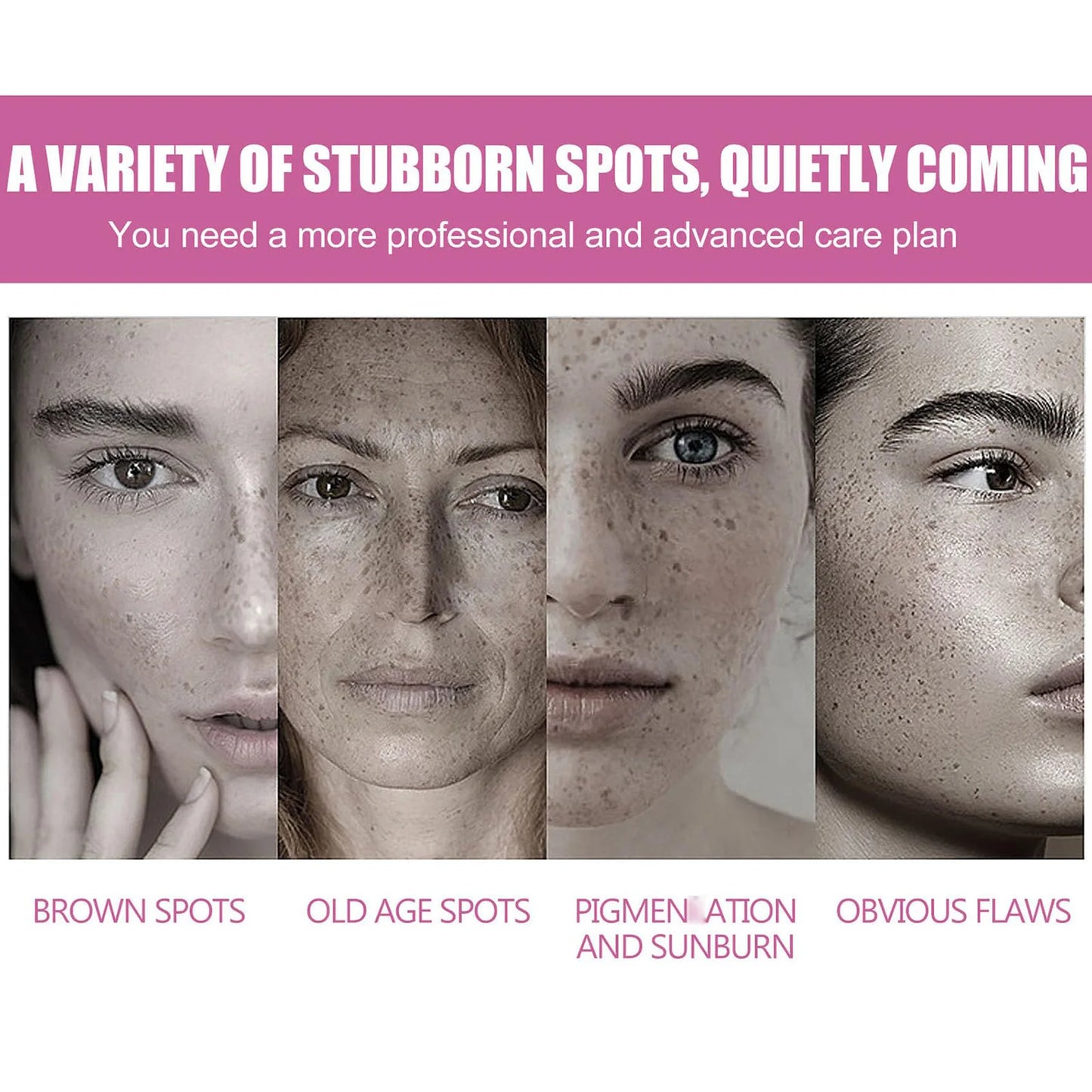 Dark Spot Remover for Face, Dark Spot Cream for Age Spot Sun Spot Freckles Melasma Brown Spot with Natural Formula, Dark Spot Co Peaceful Pleasures Health and Wellness