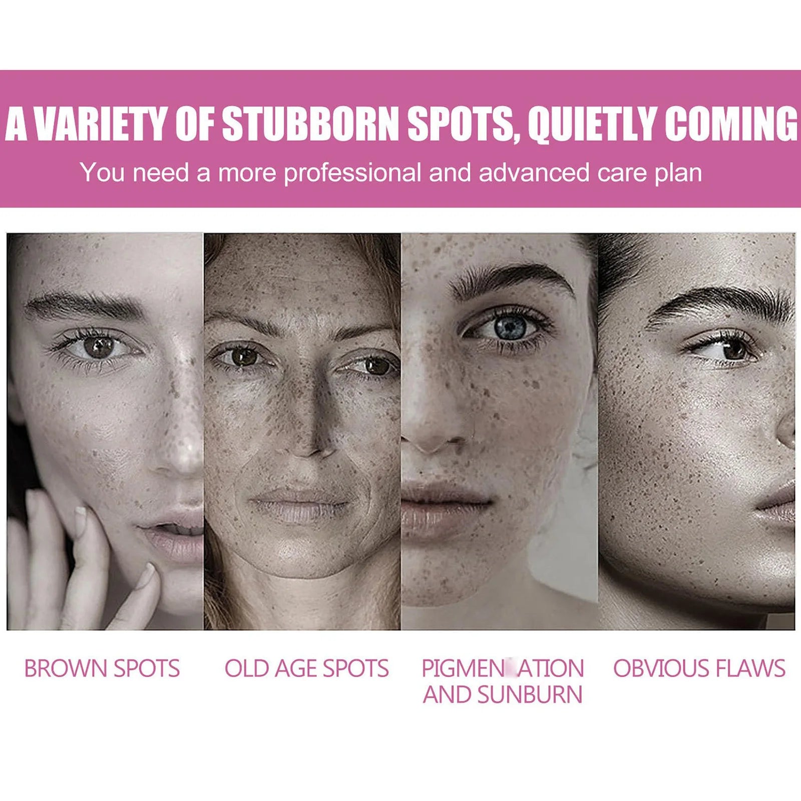 Dark Spot Remover for Face, Dark Spot Cream for Age Spot Sun Spot Freckles Melasma Brown Spot with Natural Formula, Dark Spot Co Peaceful Pleasures Health and Wellness