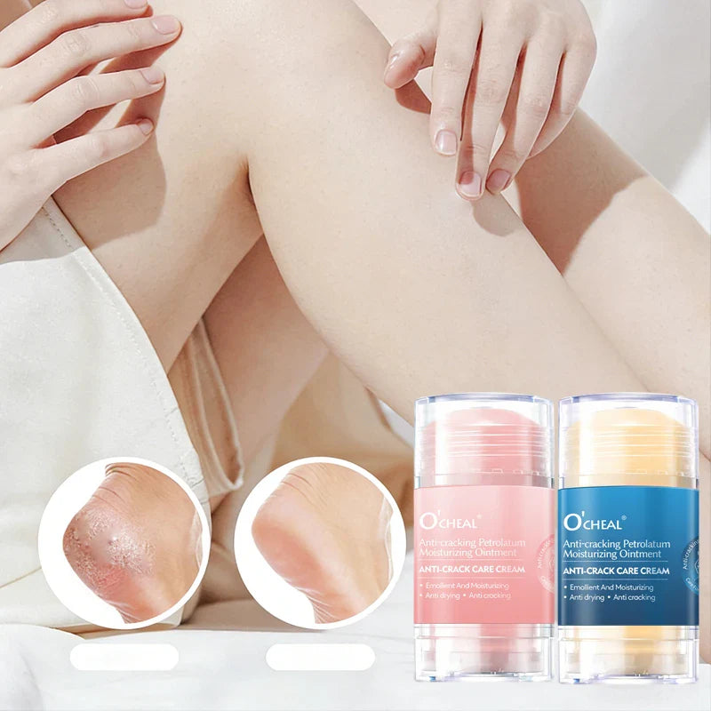 2-Pack Anti-Crack Hand & Foot Cream for Dry & Cracked Skin