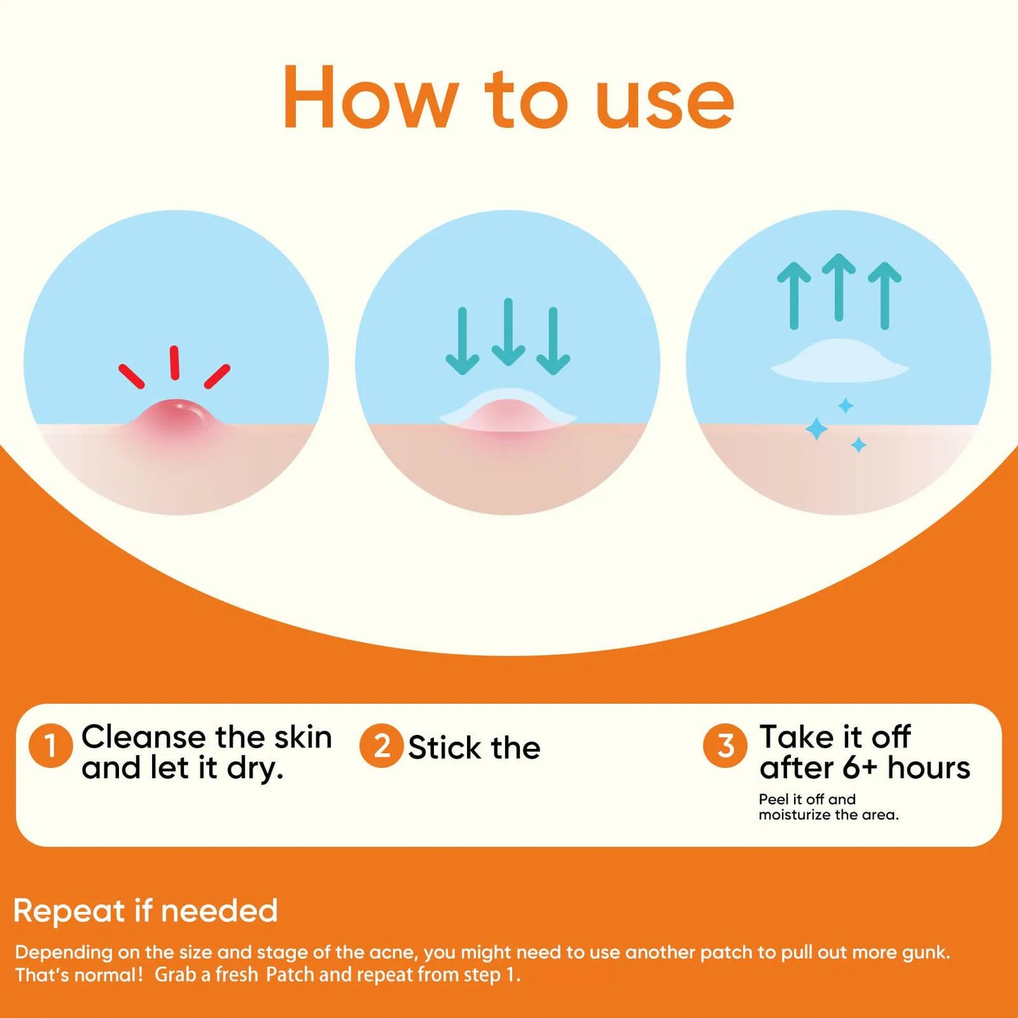 Hydrocolloid Acne Patches | Alcohol-Free Pimple Dots 18/36/135ct