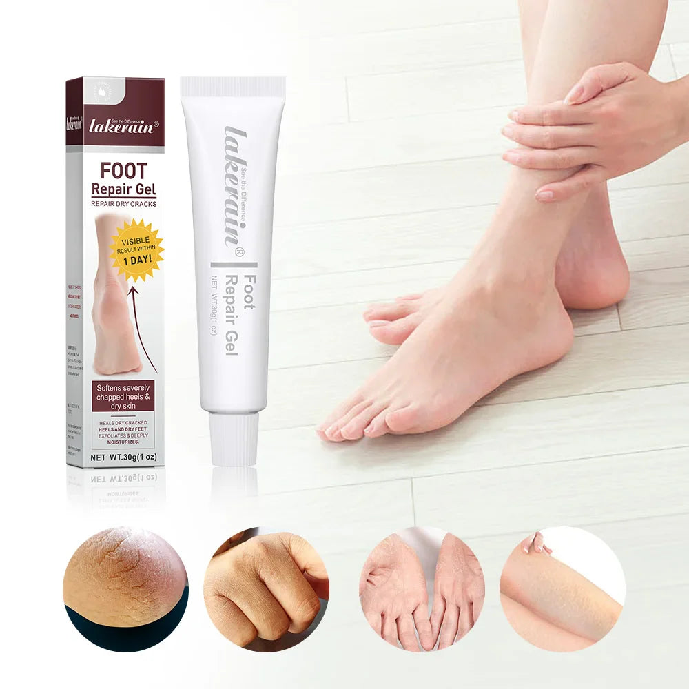 Foot & Hand Repair Gel Cream – Exfoliating Moisturizer 30g