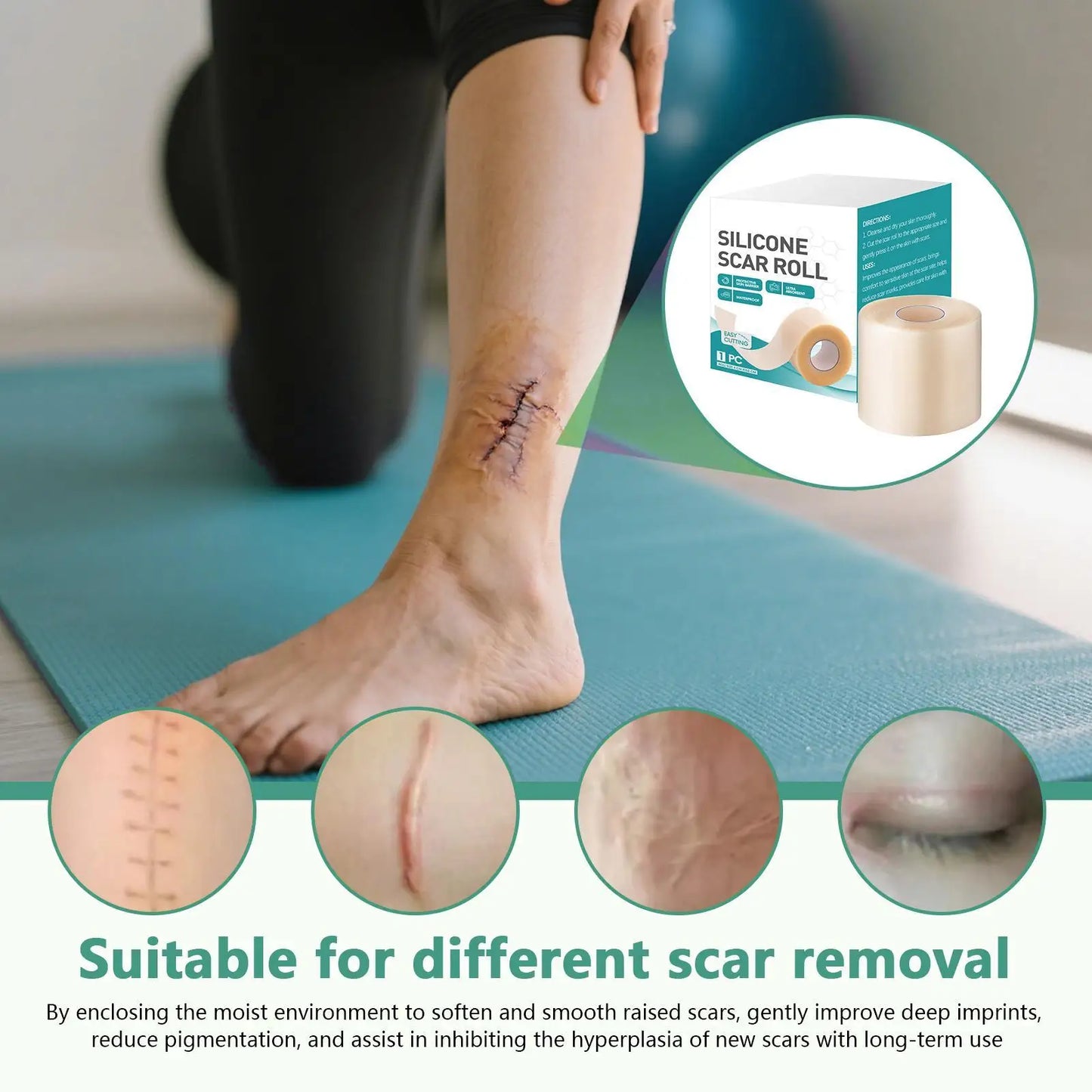 Hydrocolloid Silicone Scar Sheet Roll | Self-Adhesive Patch 4×150cm Silicone Scar Sheet Peaceful Pleasures Health and Wellness