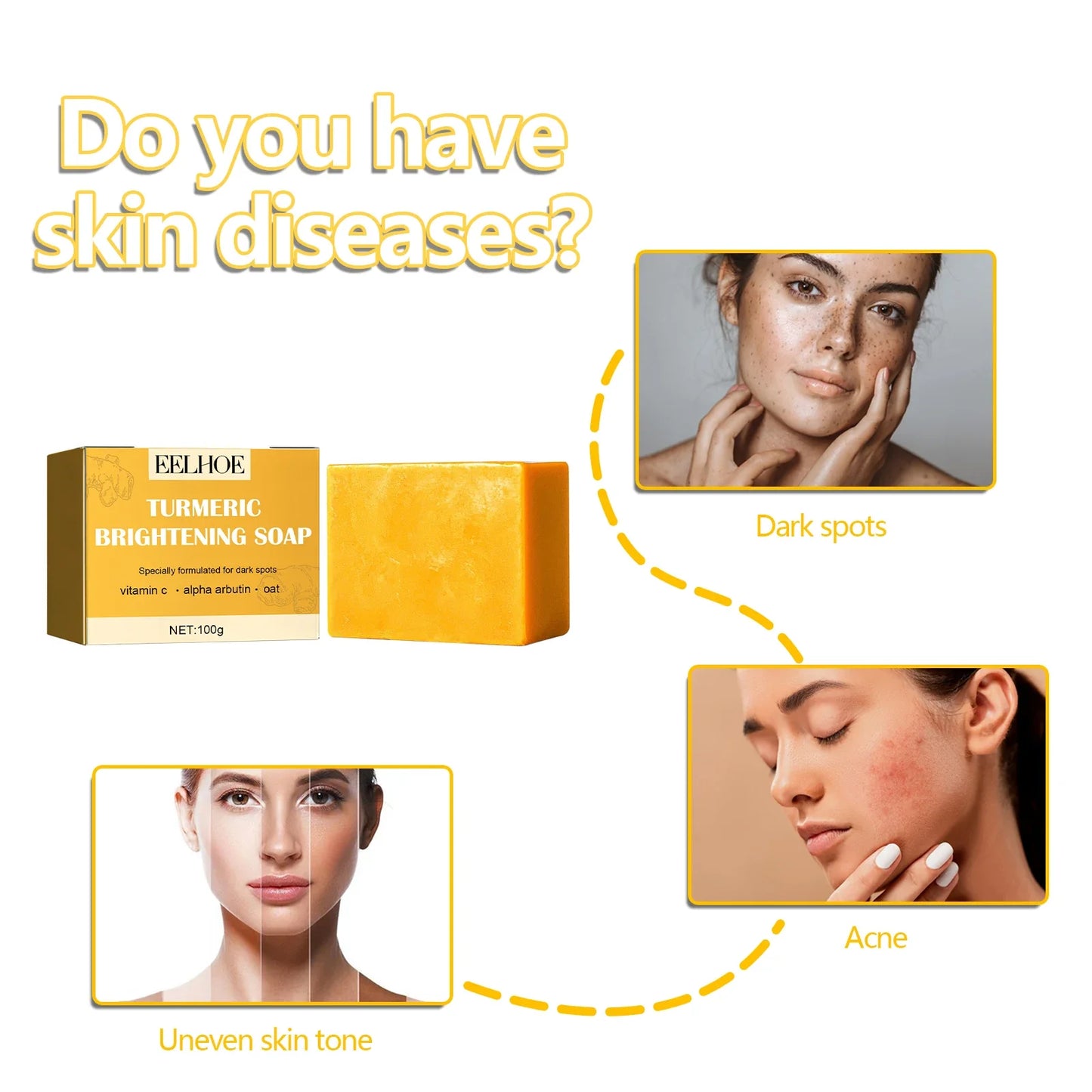Eelhoe Turmeric Face Soap – Brighten Skin & Fade Dark Spots