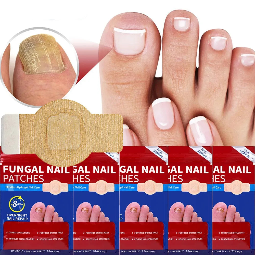 Nail Repair Patches – Ingrown Toenail & Nail Care Stickers