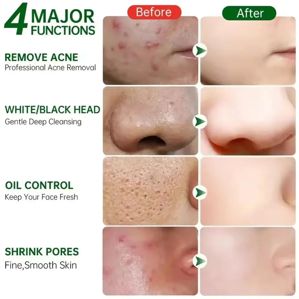 Pore Shrinking Cream Elimination Large Pores Blackehead Remove Acne Pit Repair Gel Tighten Face Smooth Skin Korean Care Products Peaceful Pleasures Health and Wellness